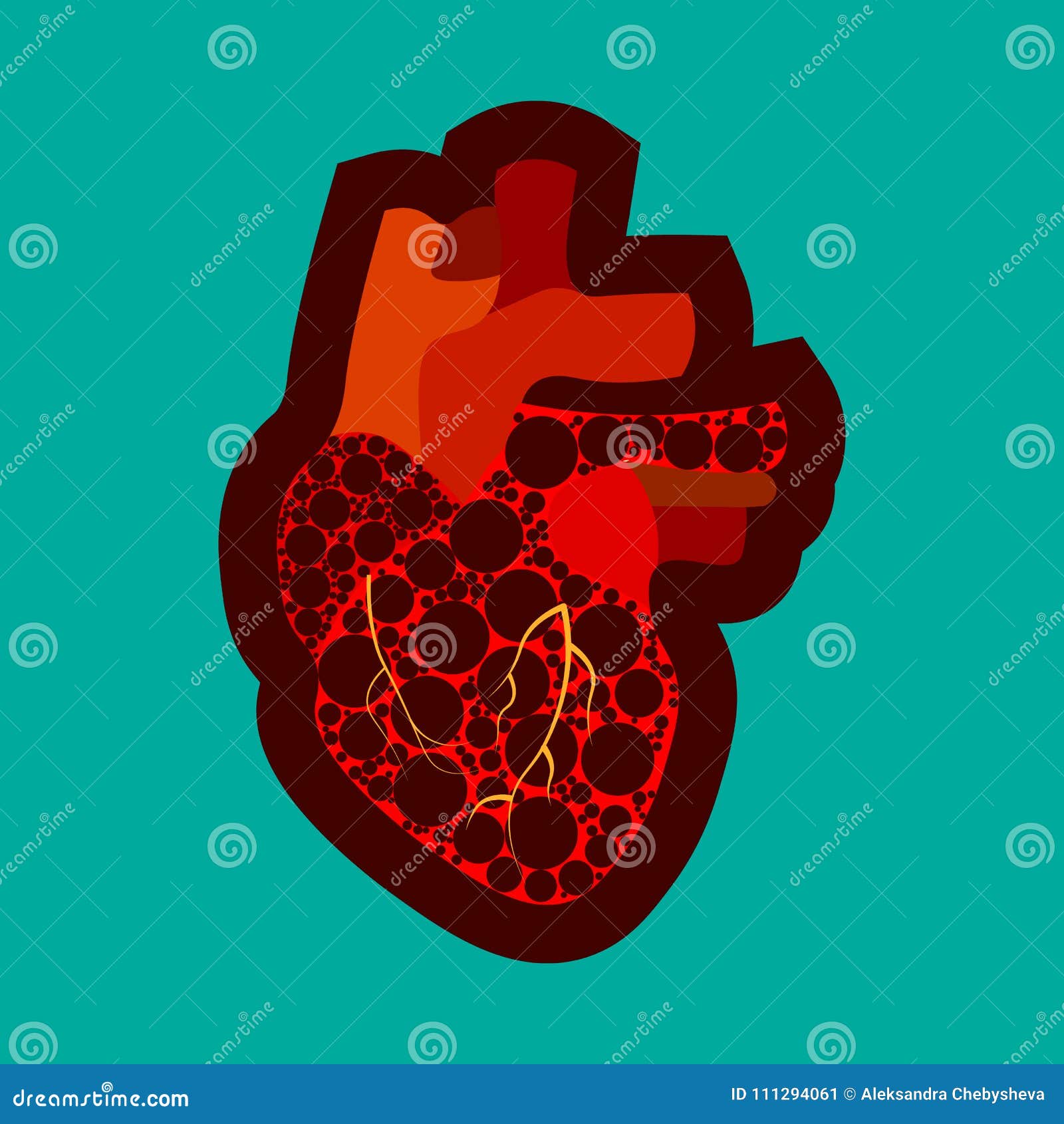 Affiche Congénitale De Conscience De Maladie Cardiaque Avec