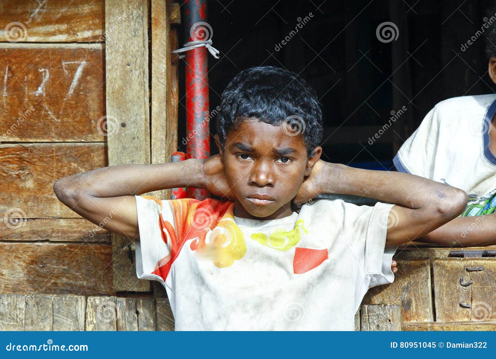 African Boy in Malgasy Village Editorial Image - Image of braid, exotic ...