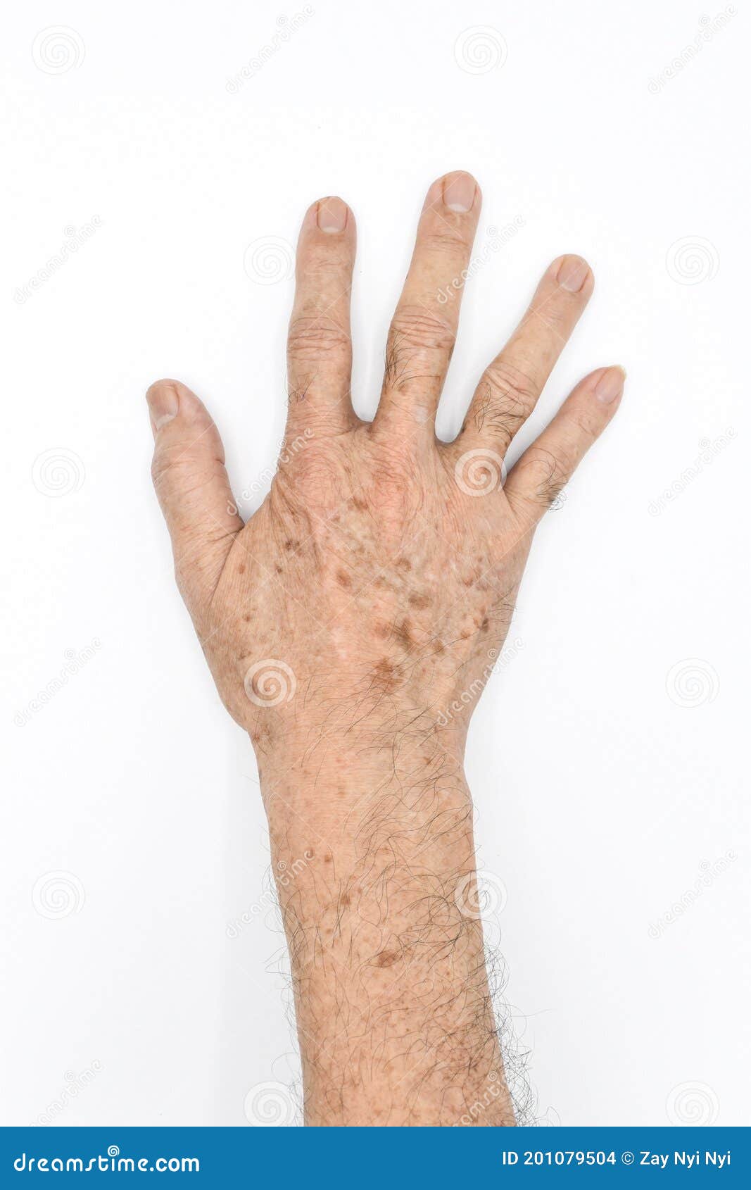 age spots on hand of asian elder man. they are brown, gray, or black spots and also called liver spots, senile lentigo, solar