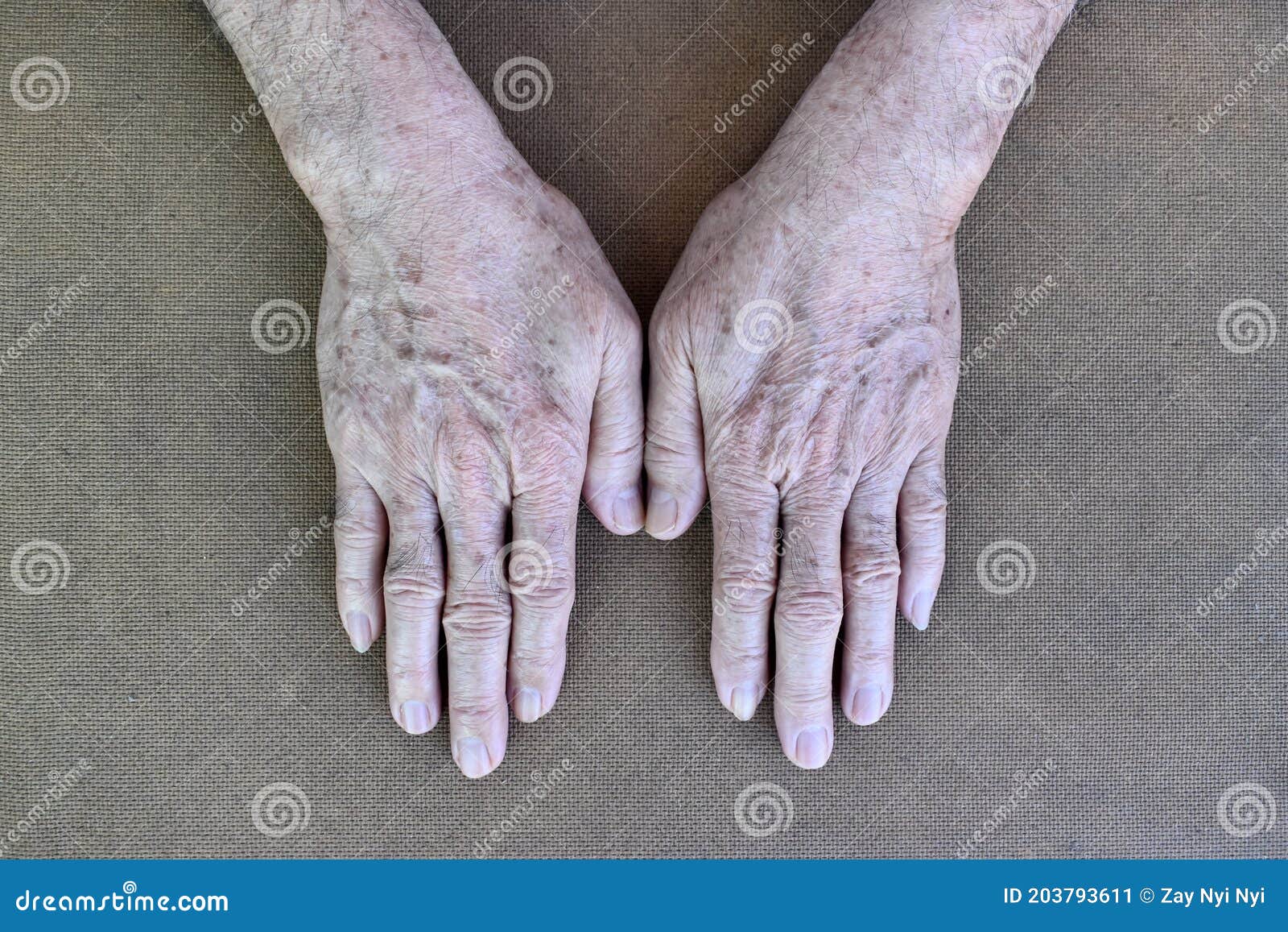 Age Spots On Hands Of Asian Elder Man They Are Brown Gray Or Black