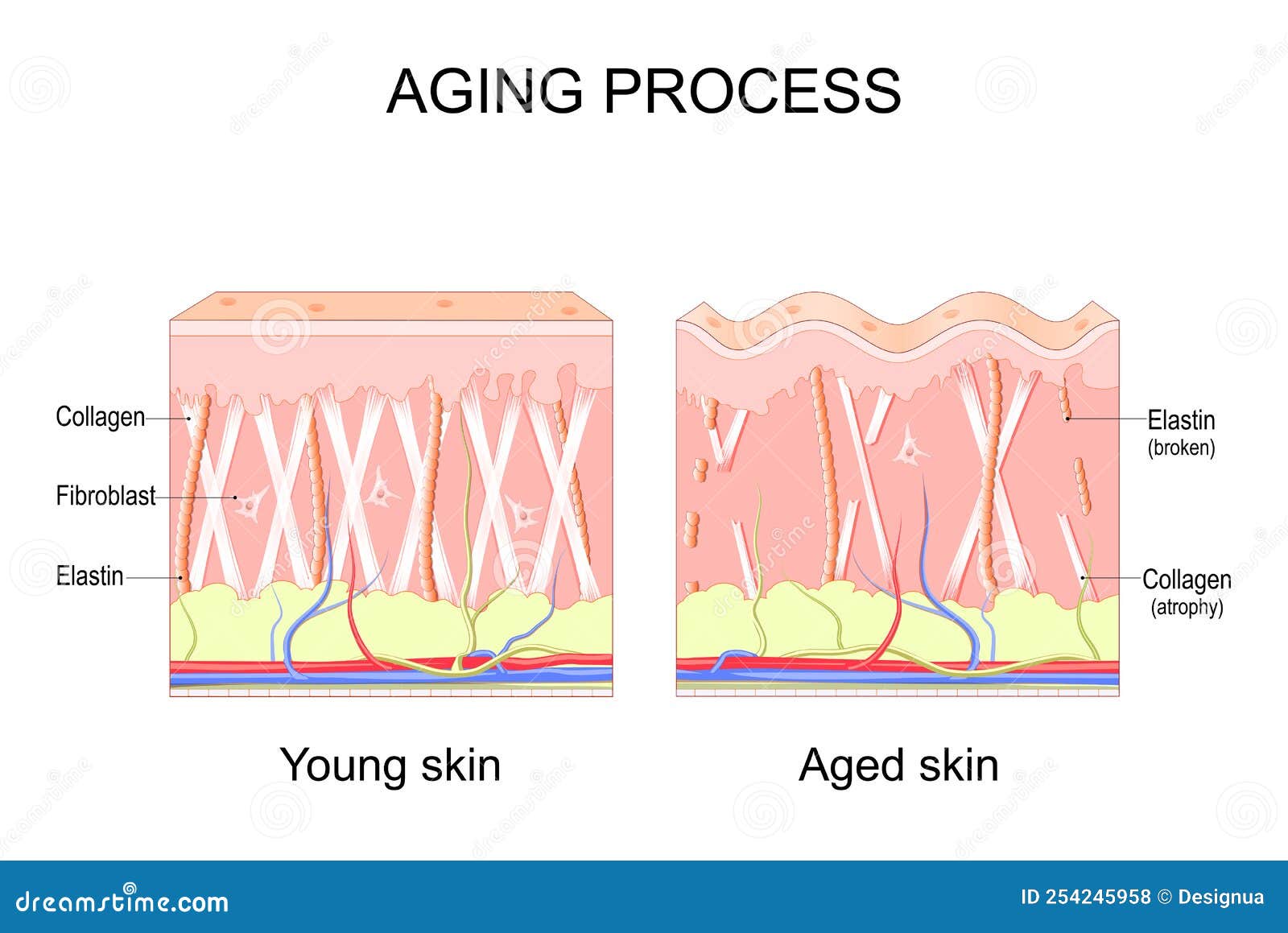 aging process. comparison of young and aged skin. collagen, elastin and fibroblasts