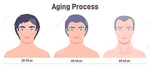 Aging Process Face Skin Changes Man Getting Wrinkles With Age Stock 