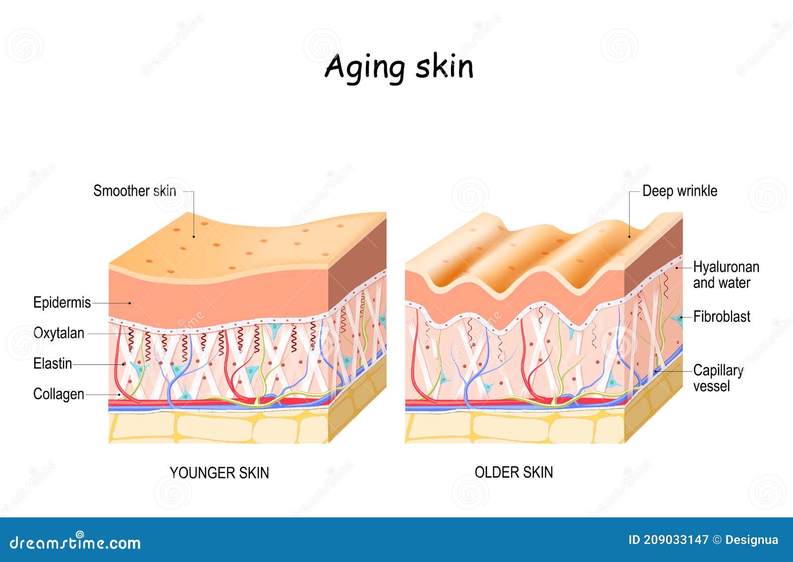 aging skin. collagen  elastin  and oxytalan fibers. hyaluronic acid
