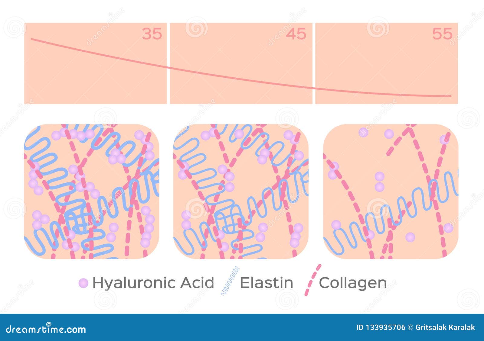 aging skin level / hyaluronic acid / elastin / collagen