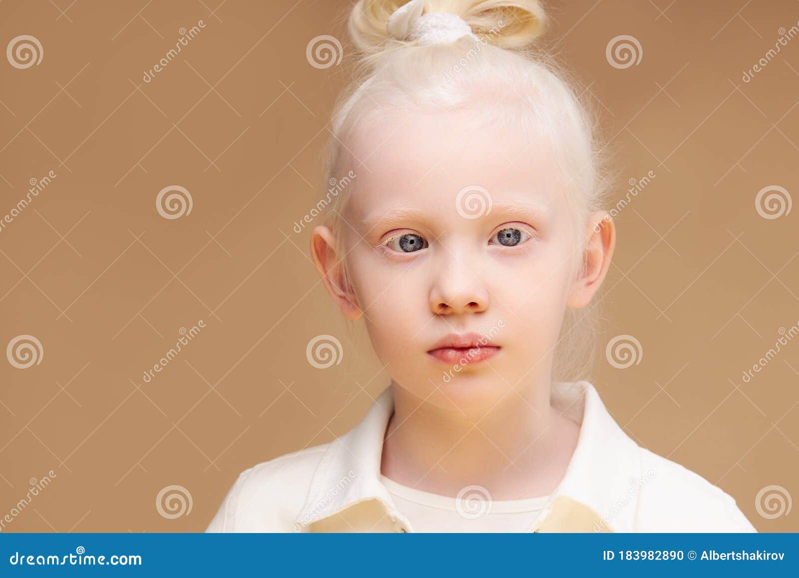 Albino Kid Girl with White Skin and White Hair Isolated Stock Photo - Image of background, grey: 183982890 Albino Kid Girl with White Skin and White Hair Isolated Stock Photo - Image of background, grey: 183982890