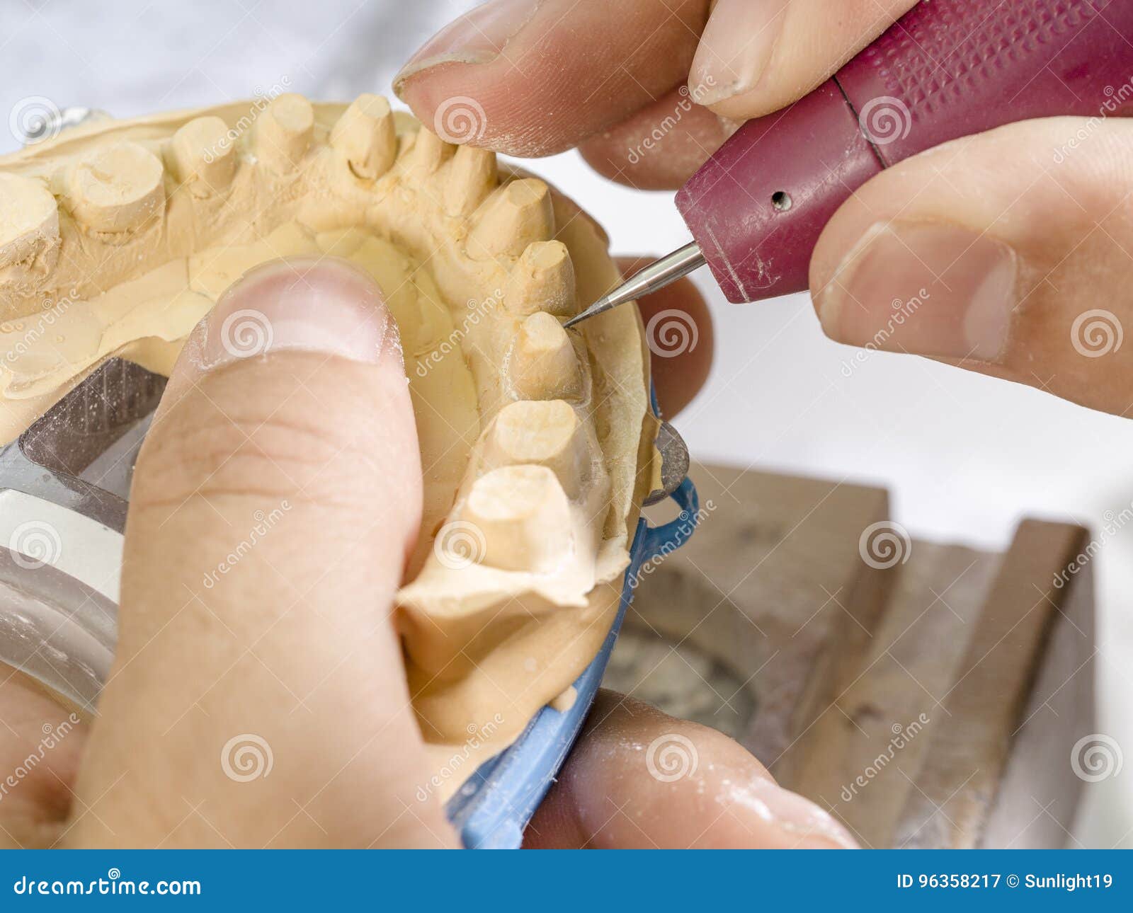 Alcohol Spirit Burner in a Dental Lab Stock Image Image of profession