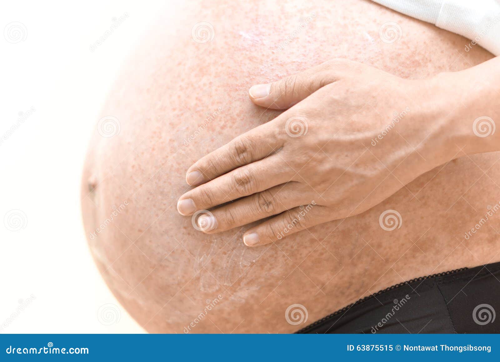 Зуд после беременности. Пигментация беременных. Пигментация кожи на животе.