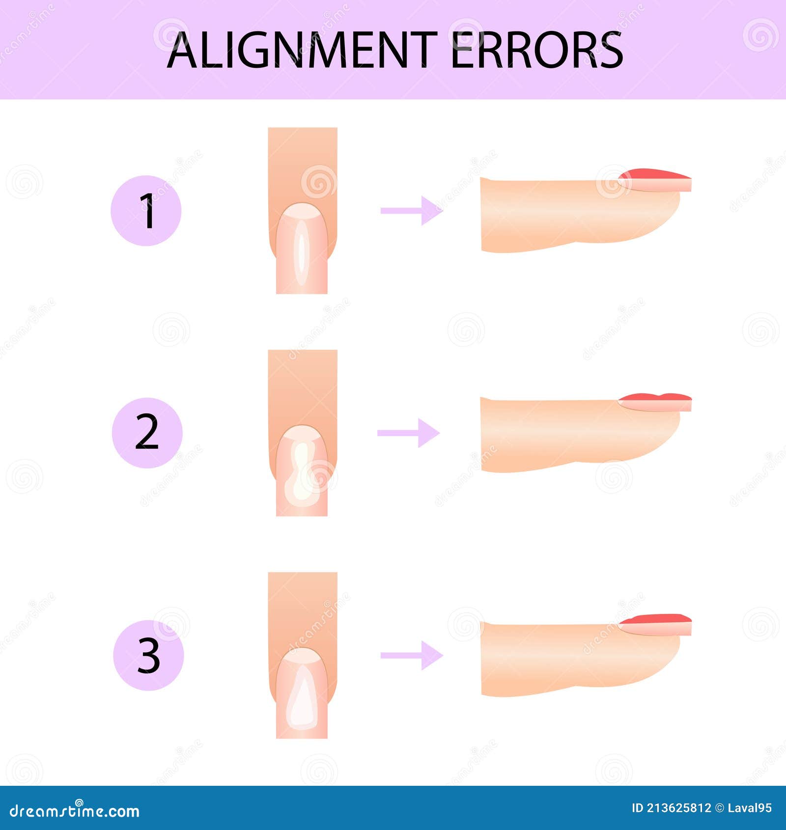 alignment of the nail plate. professional manicure guide,  , infographics