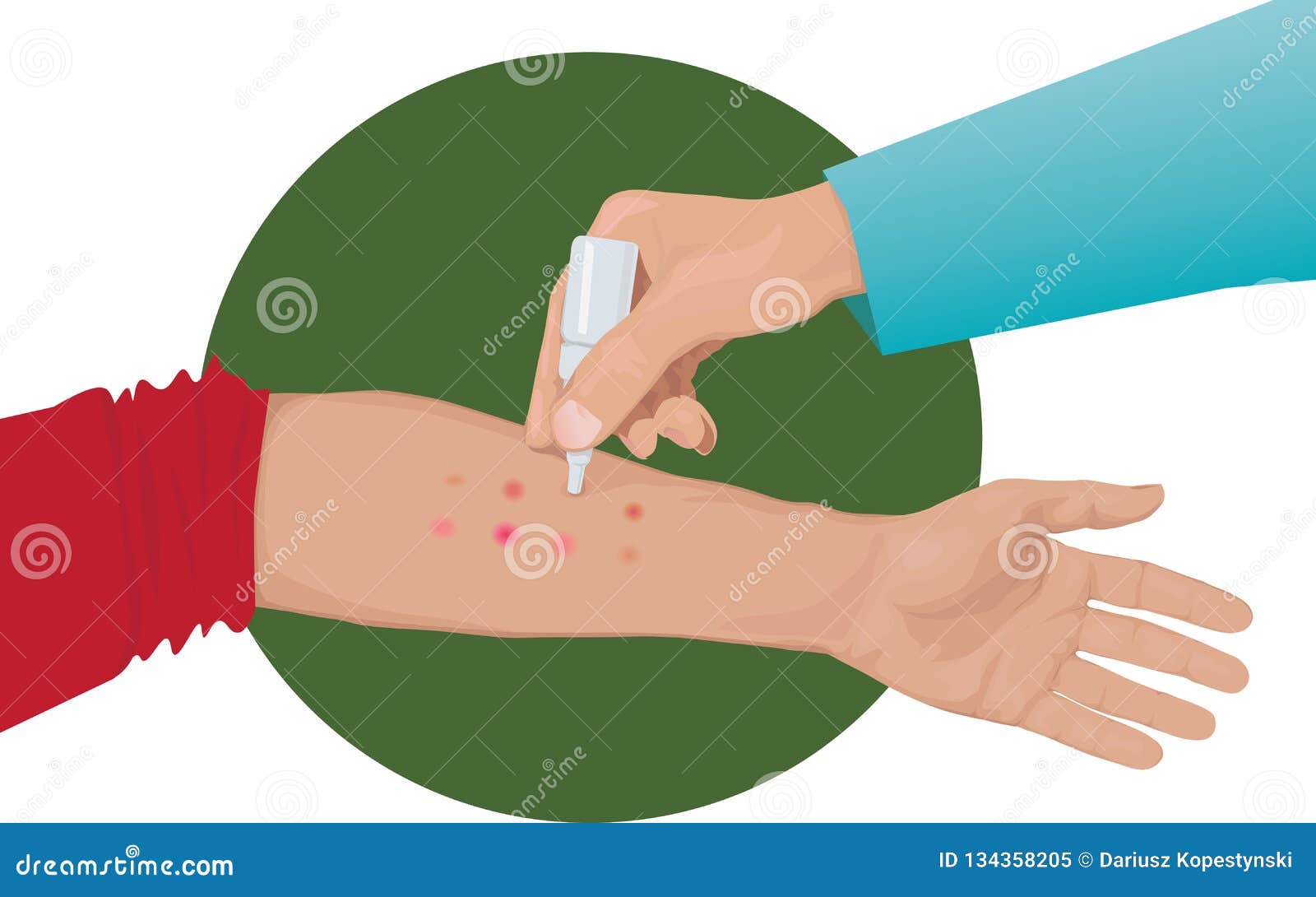 allergy skin tests on hand
