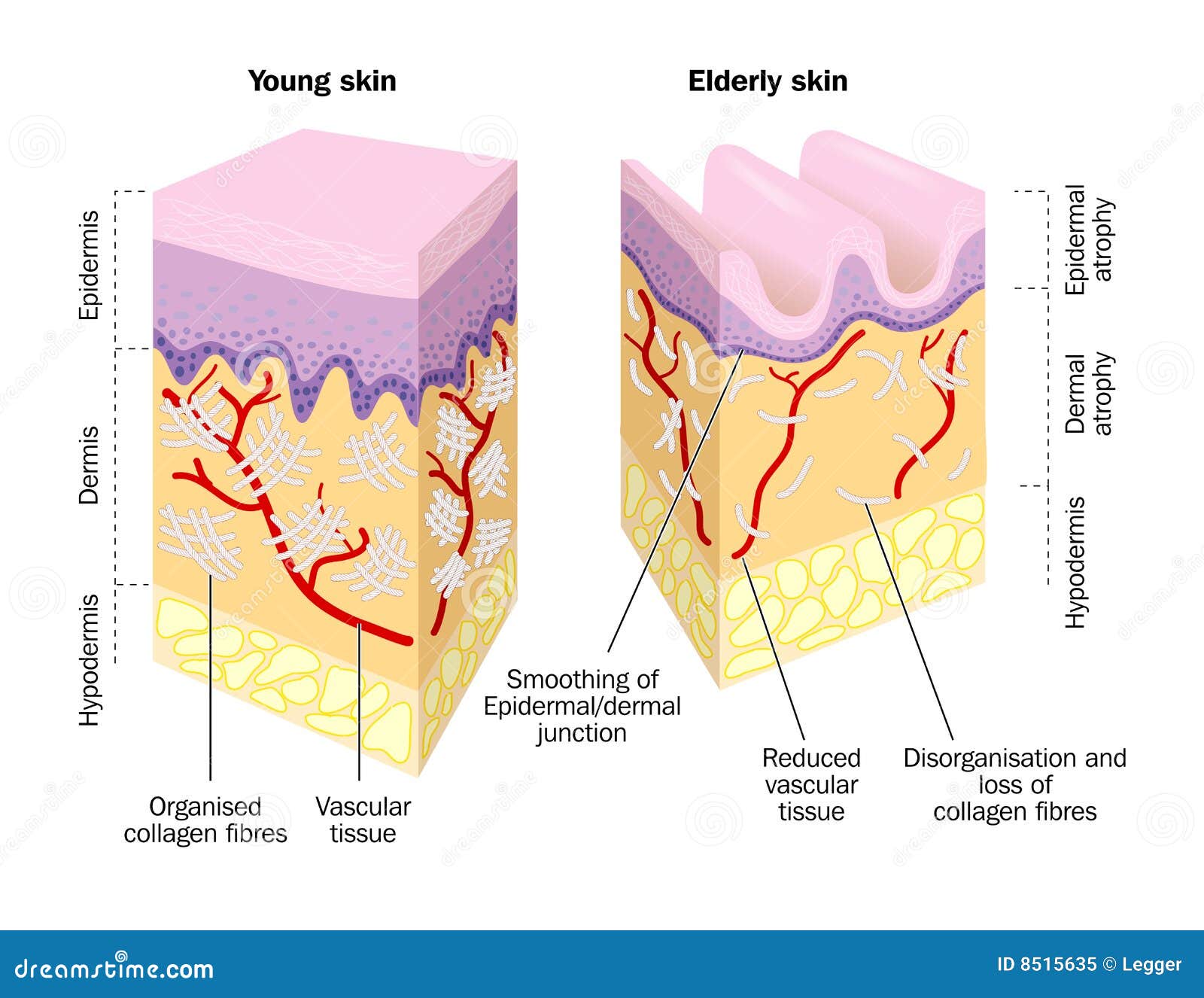 Alte und junge Haut vektor abbildung. Illustration von knicke 8515635