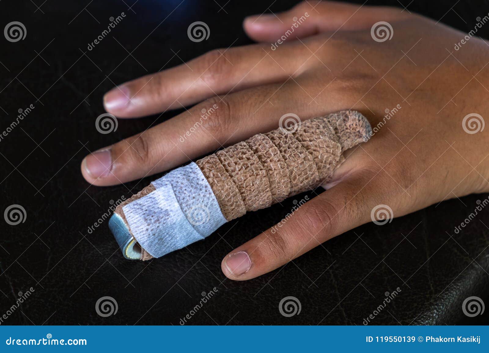 Aluminium Finger Splint on a Woman Ring Finger, Treatment of Fin Stock  Image - Image of hand, little: 119550139
