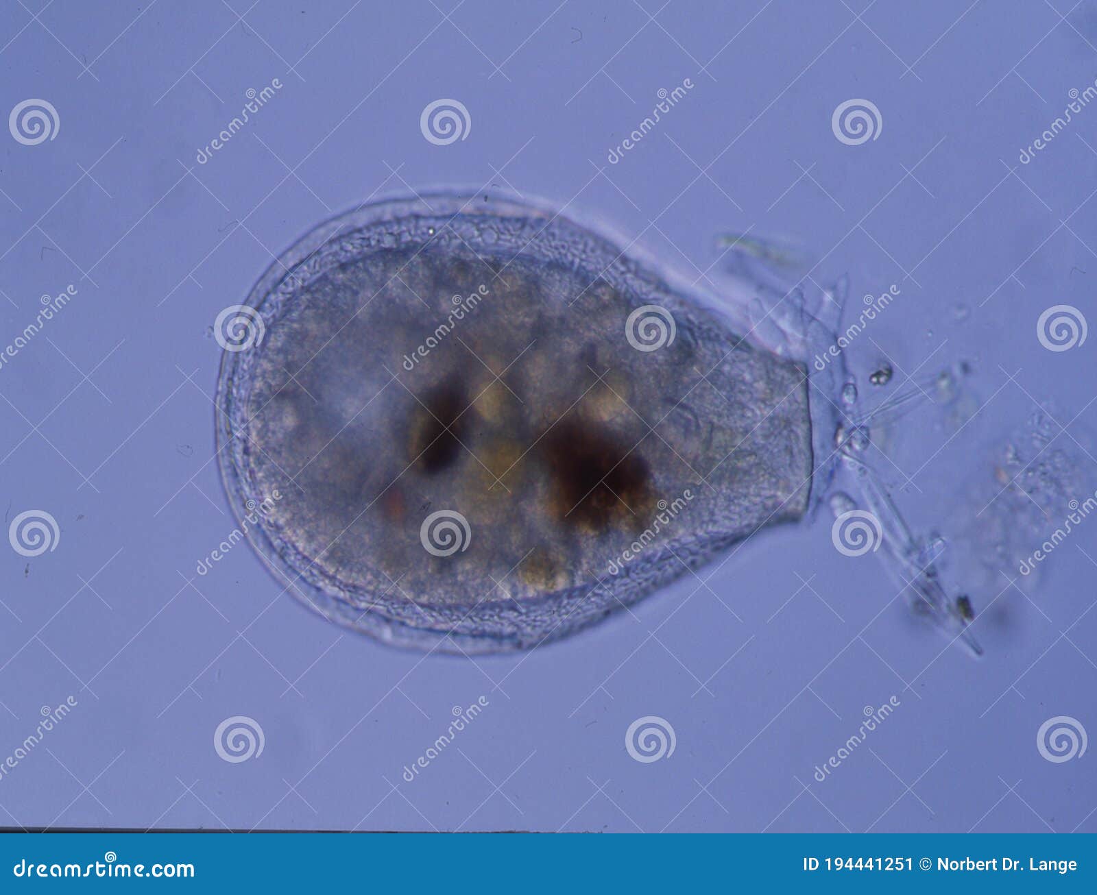 Amoeba with false feet stock image. Image of transparent 194441251