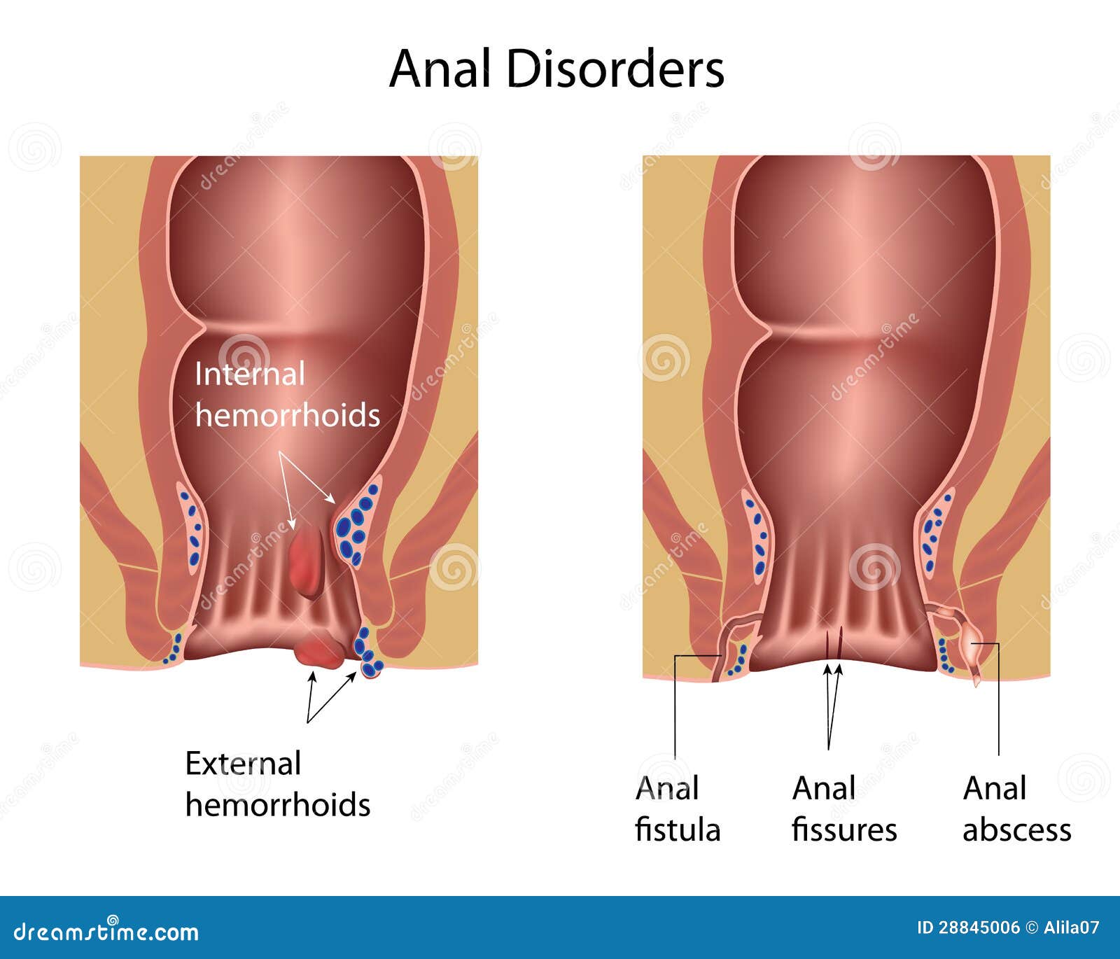 face view of anal use