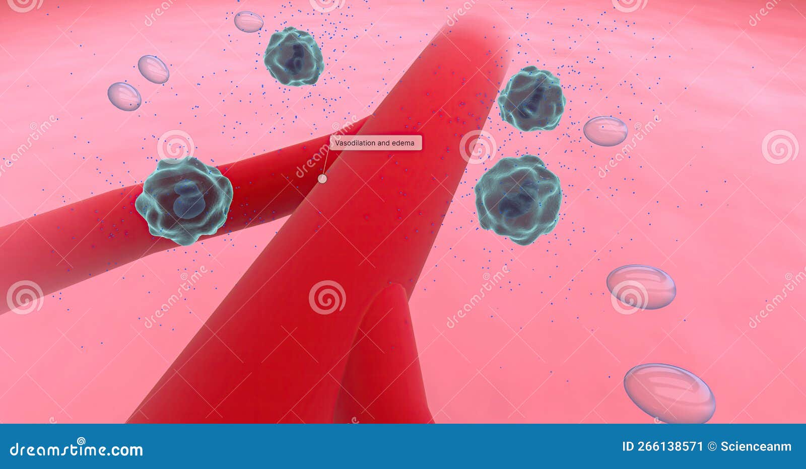 Anaphylaxis, Histamine Release and Vascular Edema Stock Illustration