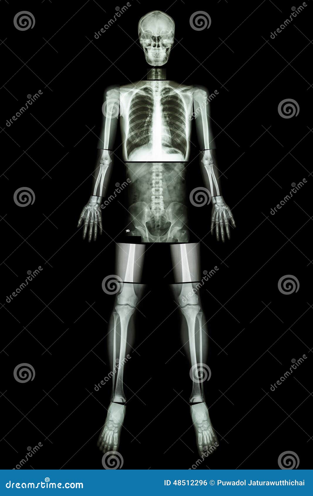 Anatomical Position. (Xray Whole Body ) Stock Photo Image 48512296