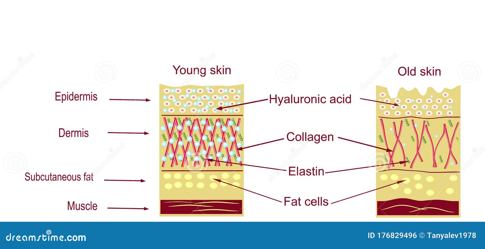 the anatomical structure of the skin. elastin, hyaluronic acid, collagen. skin aging, wrinkles before and after