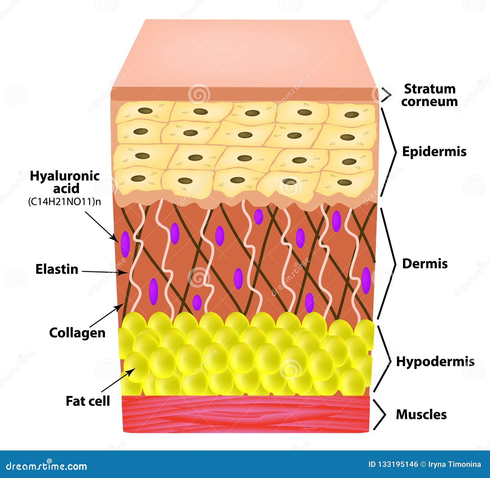 anatomical structure of the skin. elastin, hyaluronic acid, collagen. infographics. causes of wrinkles on the skin