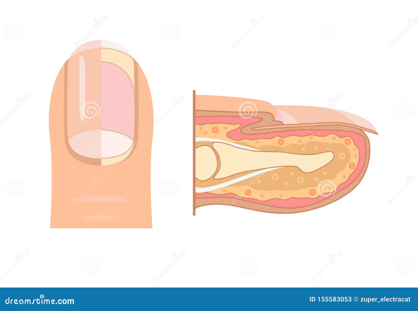 anatomy of human finger nail. medical diagram of the structure of the inside cross-section of the fingers.  infographic