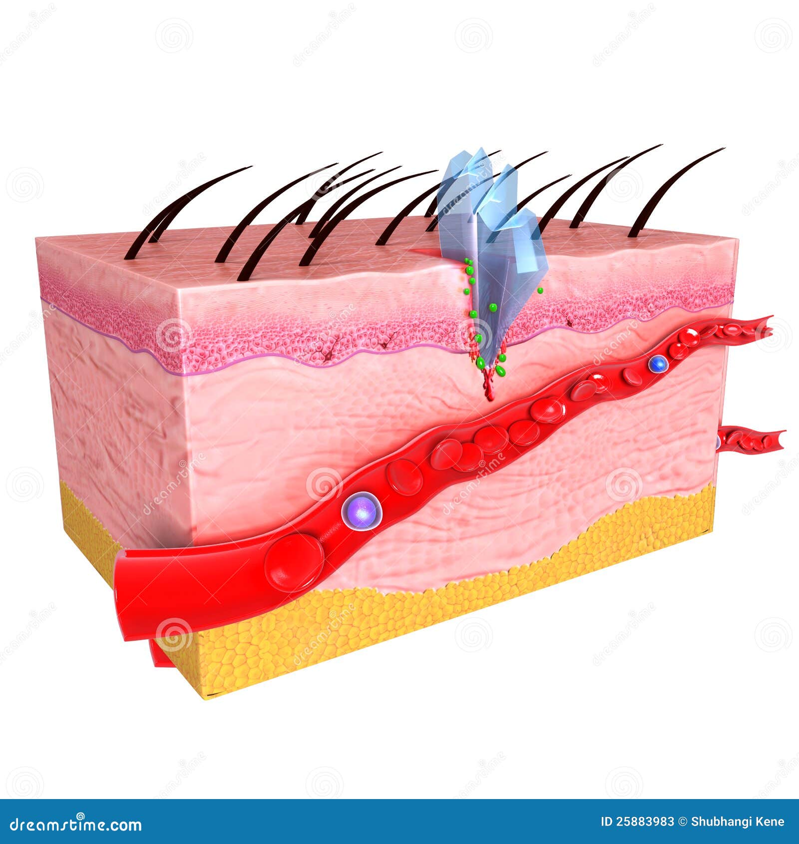 Anatomy Of Immune Response Of Skin Stock Illustration - Illustration of