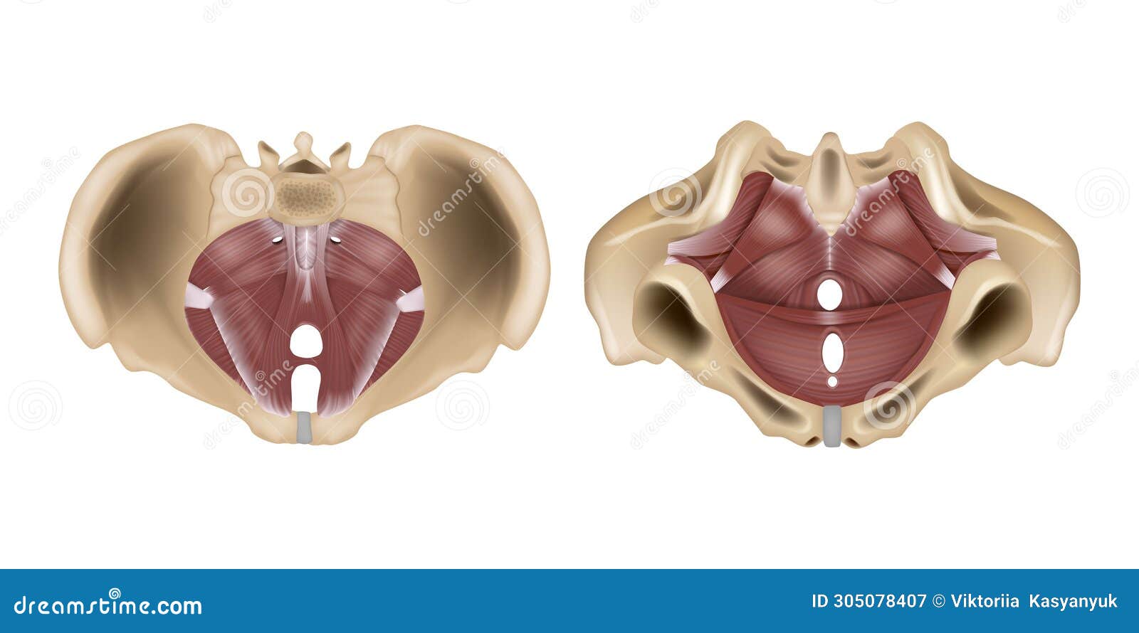 Stages of Uterine Prolapse. Pelvic Floor Muscles Weakening