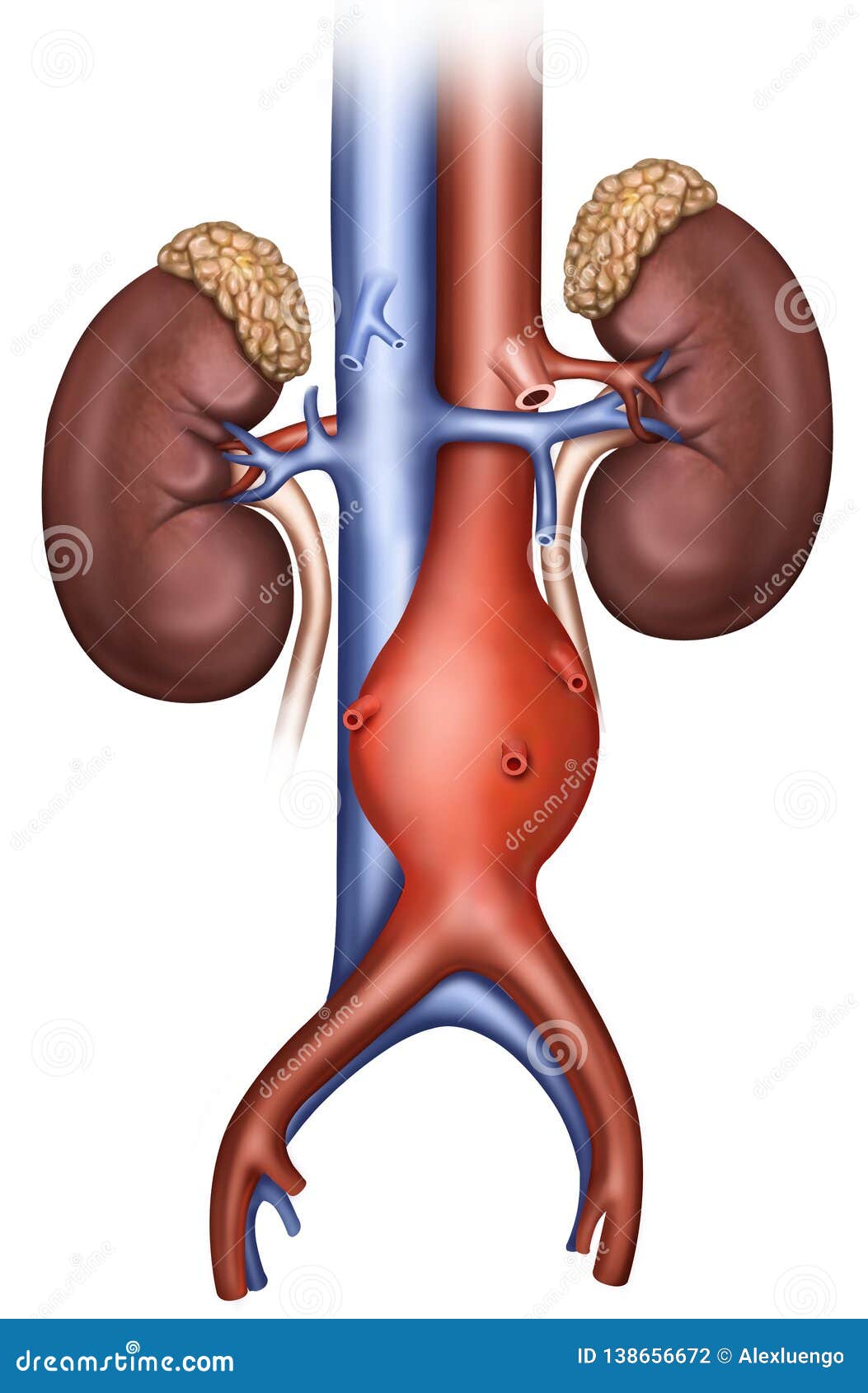 aneurisma aÃÂ³rtico abdominal