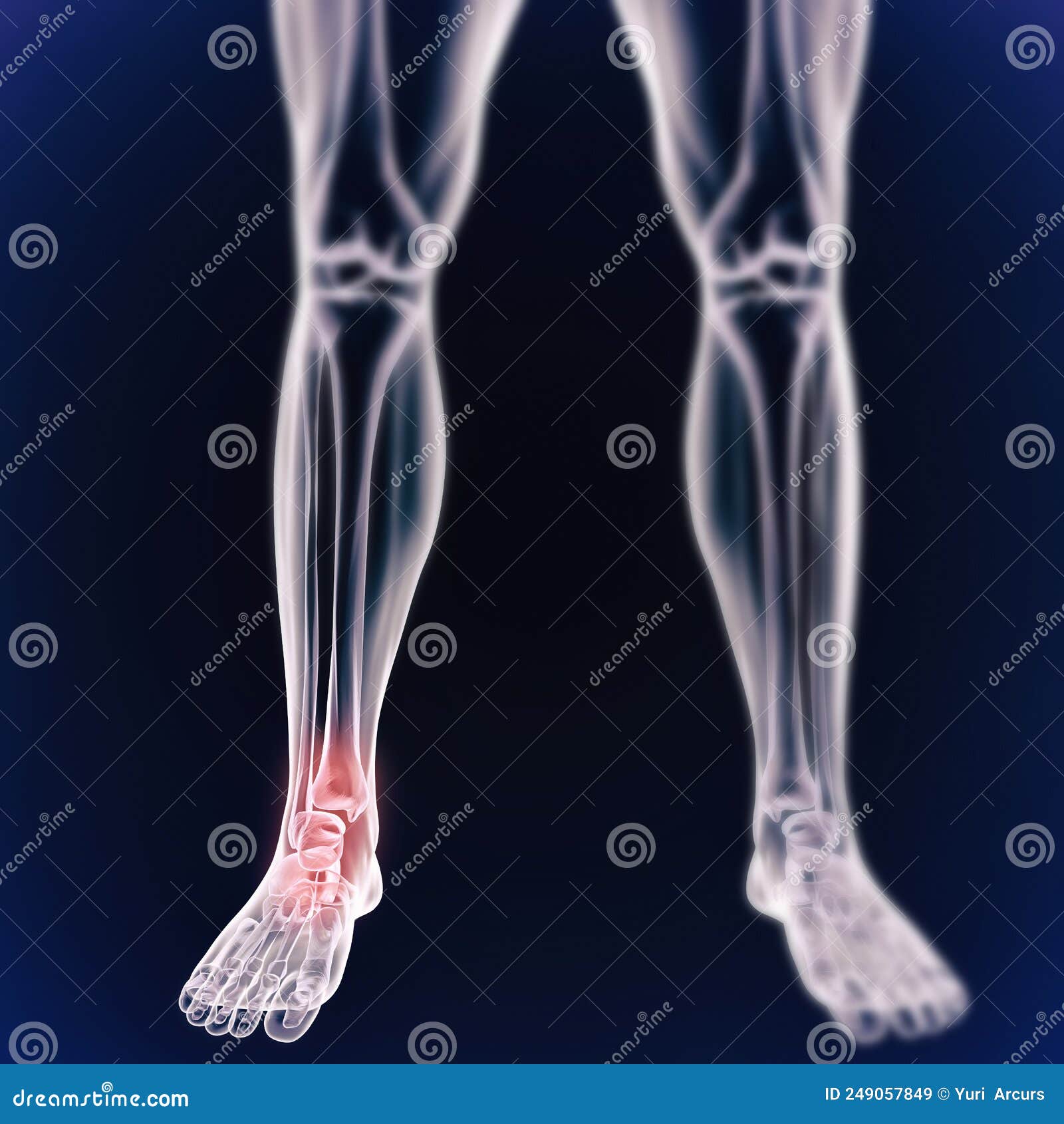 Angle and Joint Pains. Facing the Pain of Inflammation. a Cgi View of