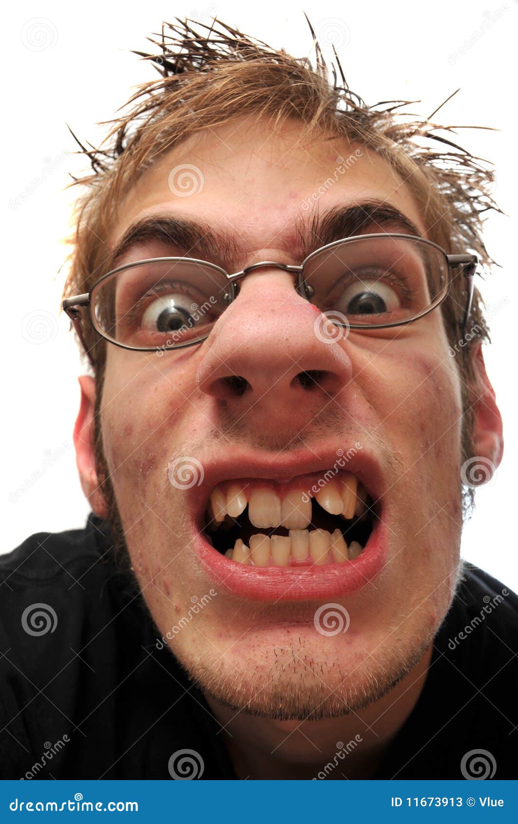 Ugly Man With No Teeth