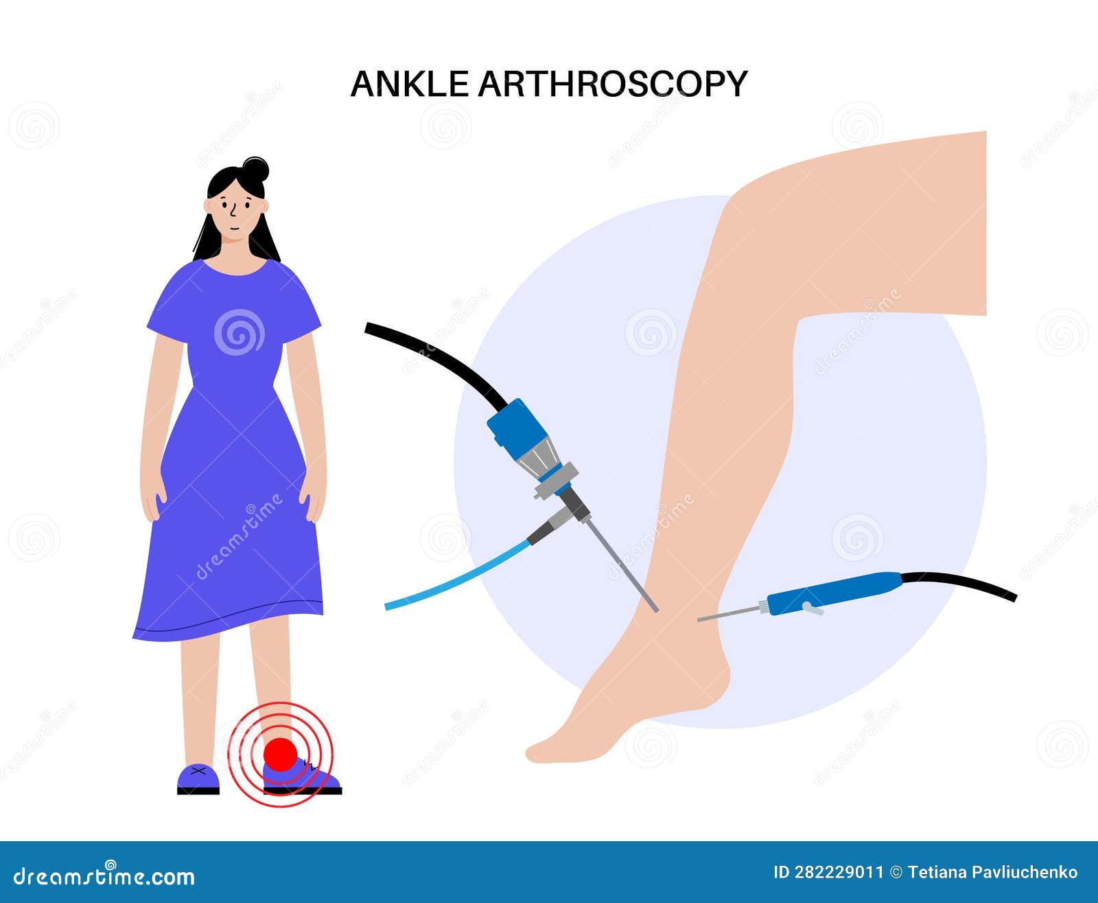 Ankle Arthroscopy Poster Cartoon Vector | CartoonDealer.com #282229011