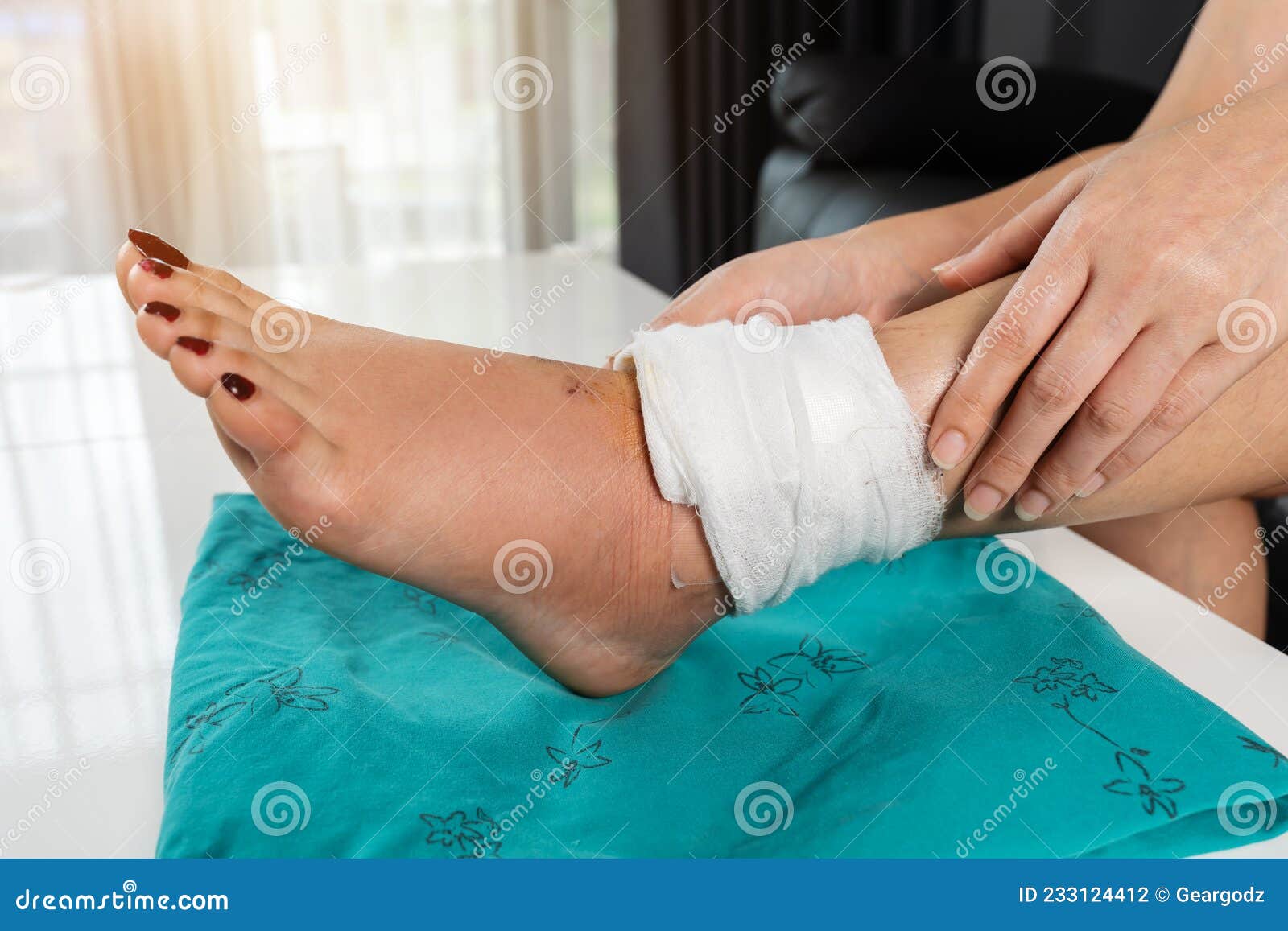 Ankle Wound With A Bandage In A Tight Fixing Bandage On A White