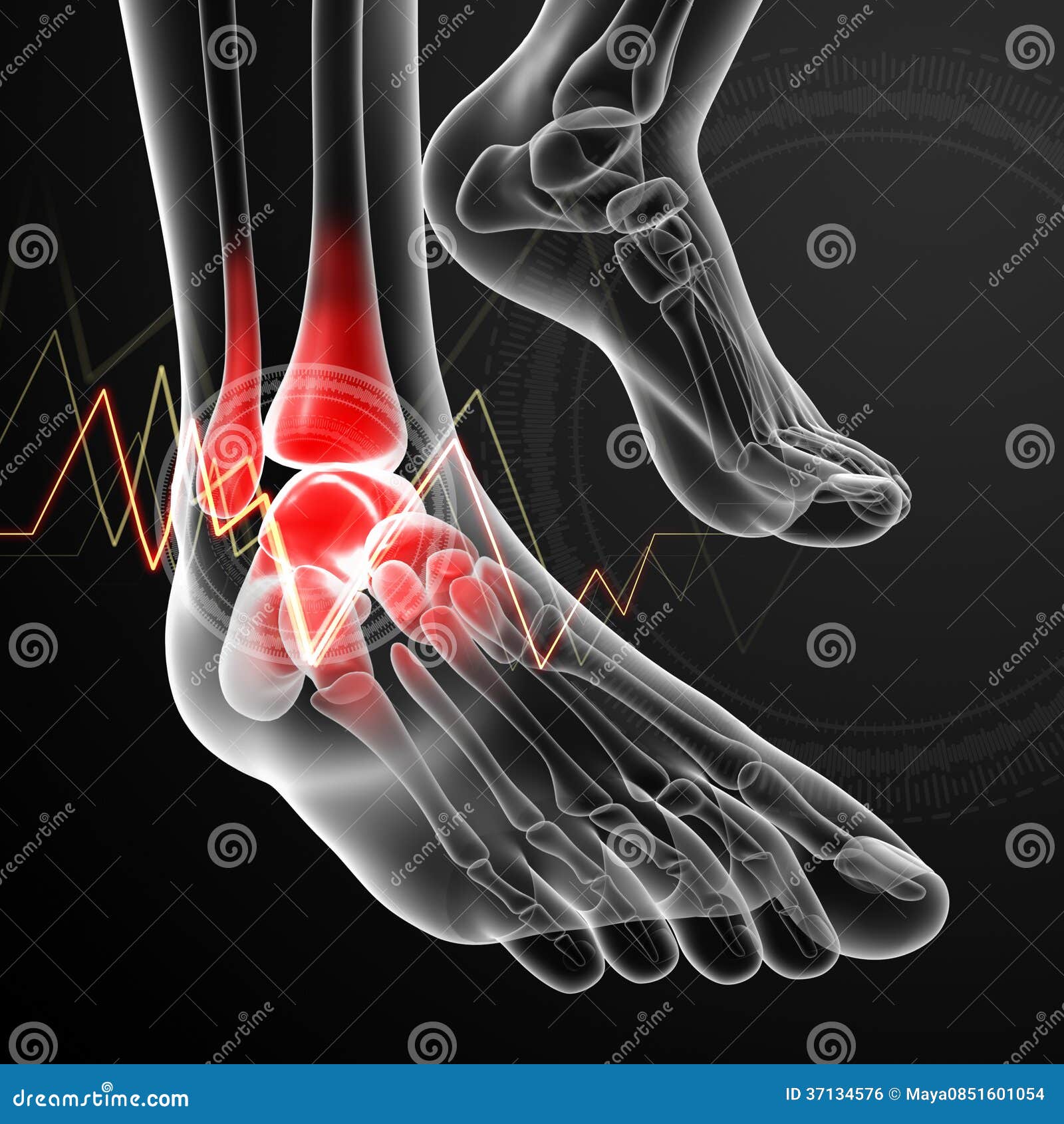 Ankle Pain In Runners, Anatomy Stock Photography