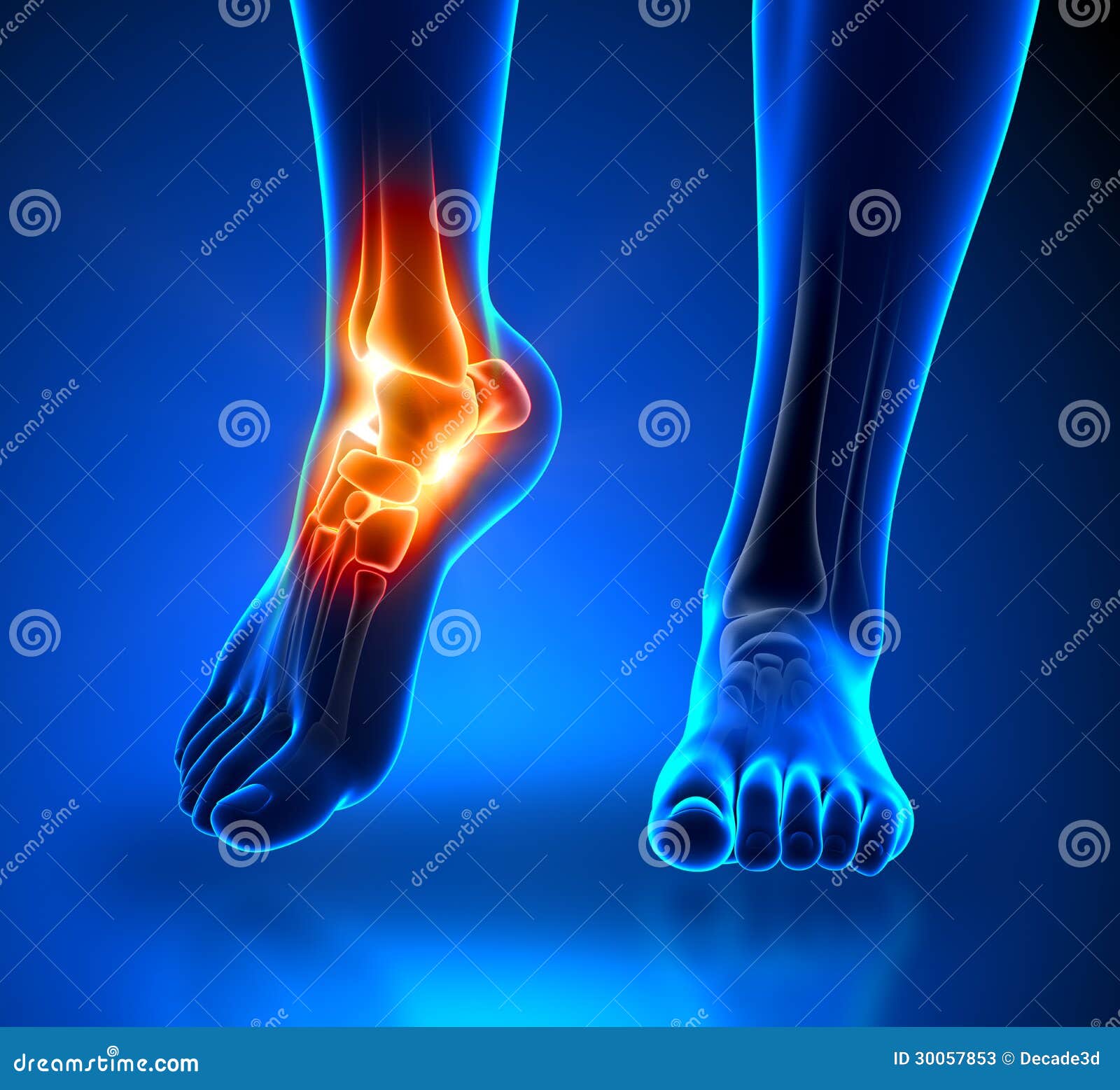 ankle pain - detail