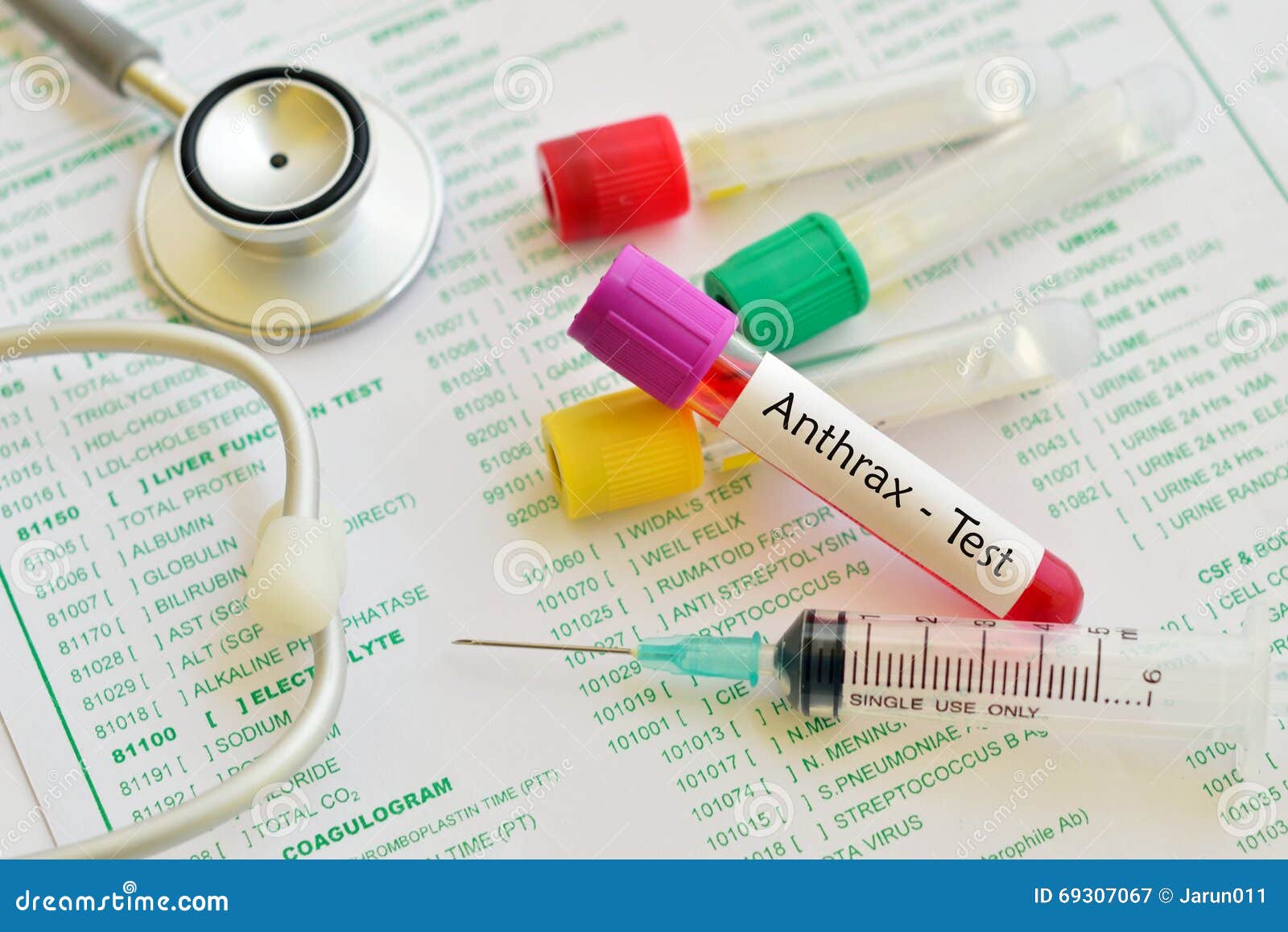 Anthrax test stock image. Image of anthrax, hematology 69307067