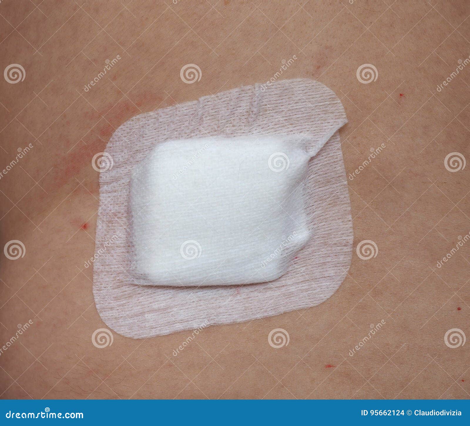 Antibacterial Woundpad Island Dressing Stock Photo Image of surgical