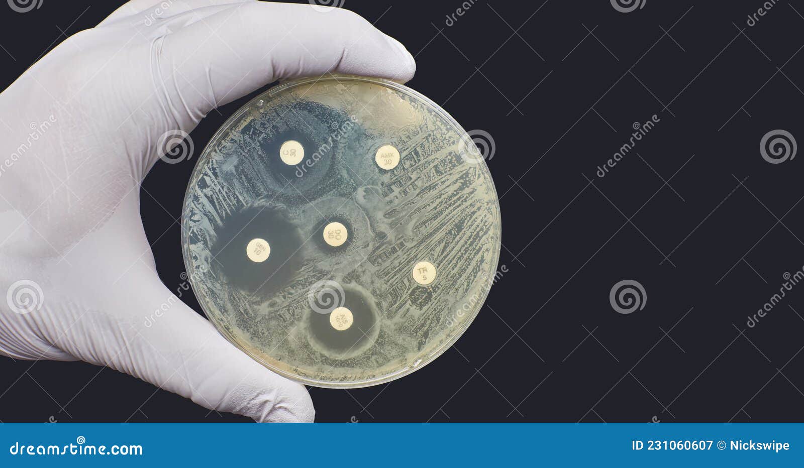 Antibiogram Kirby Bauer Antimicrobial Susceptibility Resistance Diffusion  Test Stock Image - Image of resistance, experiment: 231060607