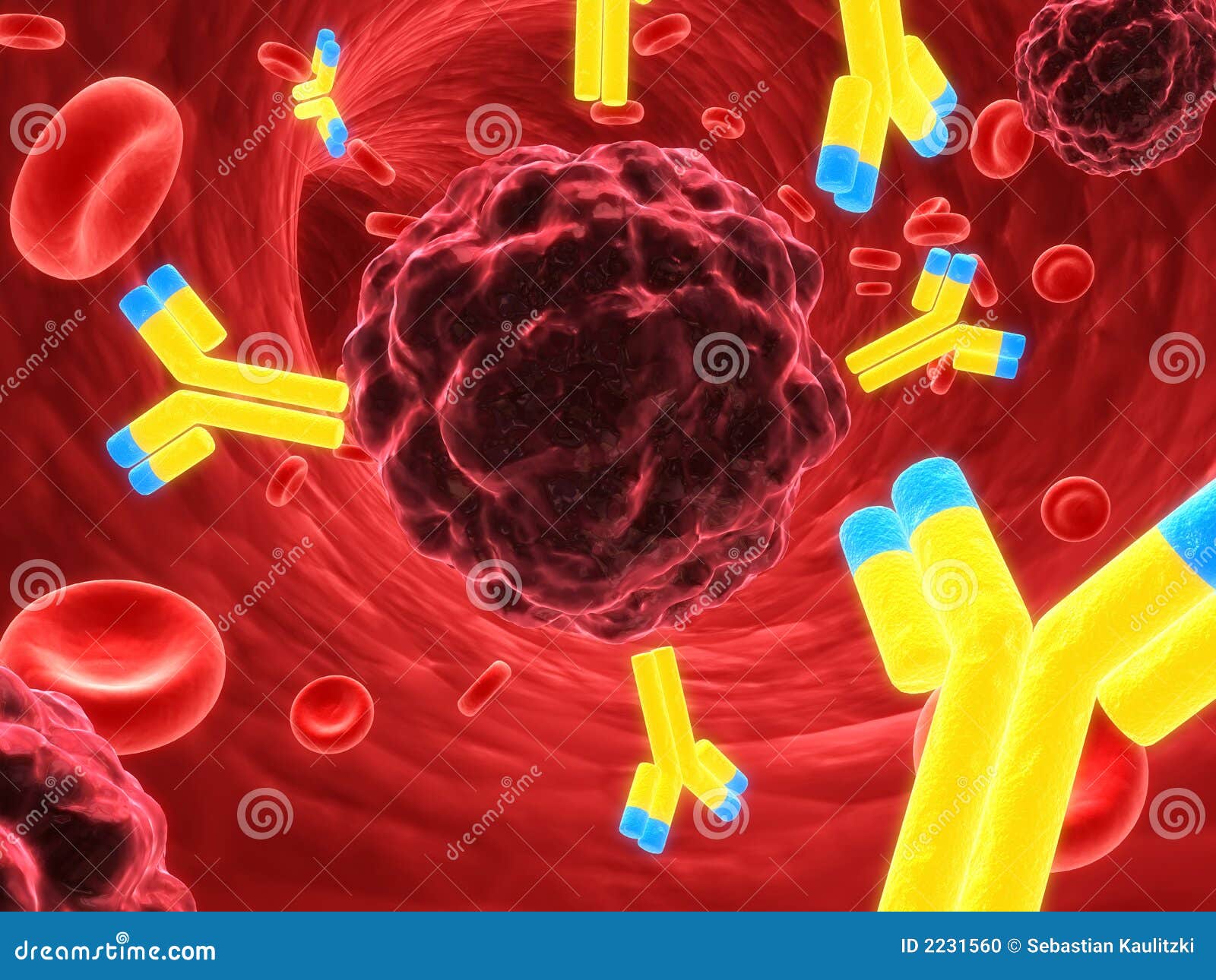 read a case approach to perioperative drug drug interactions 2015