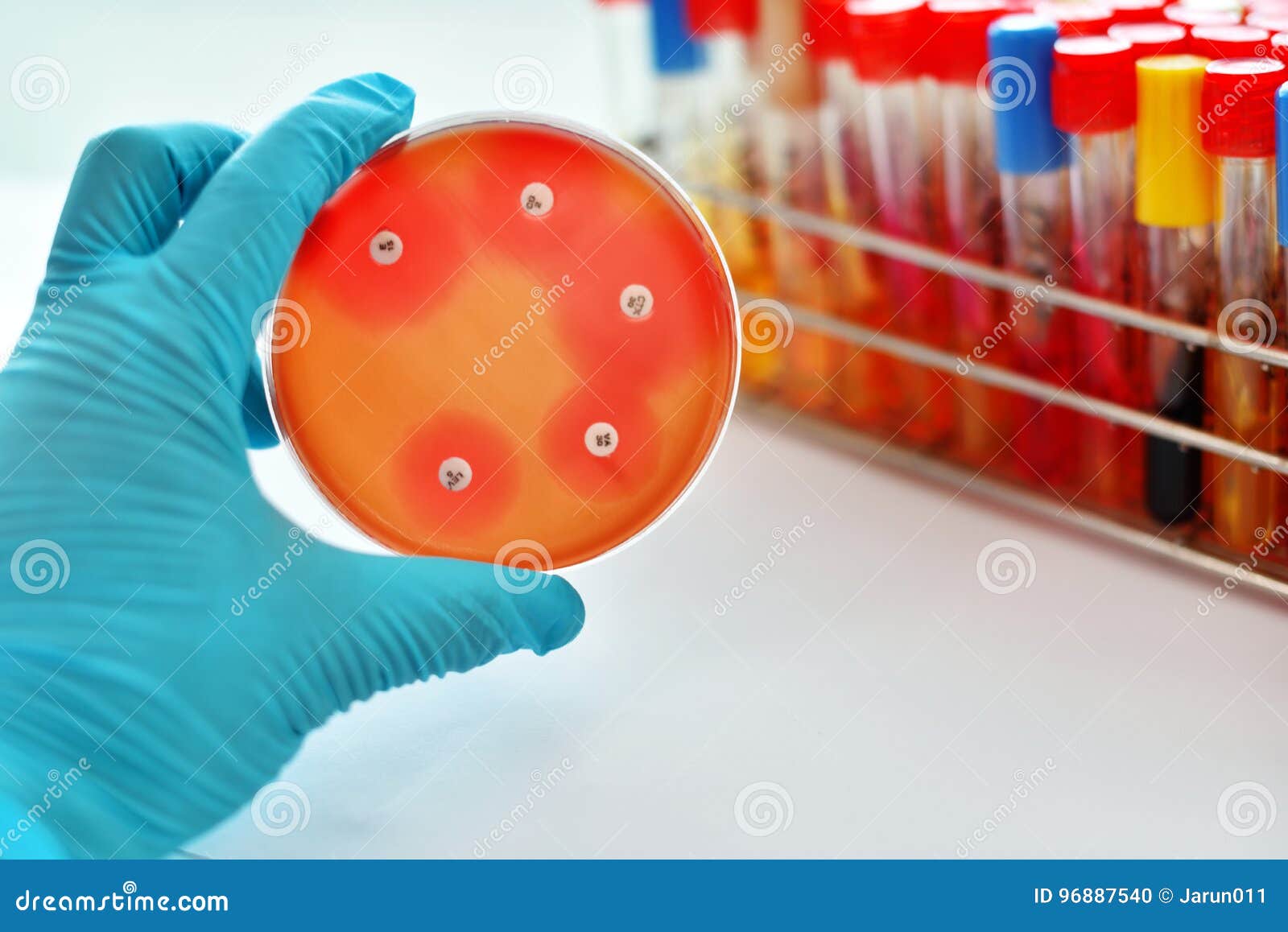 antimicrobial susceptibility test