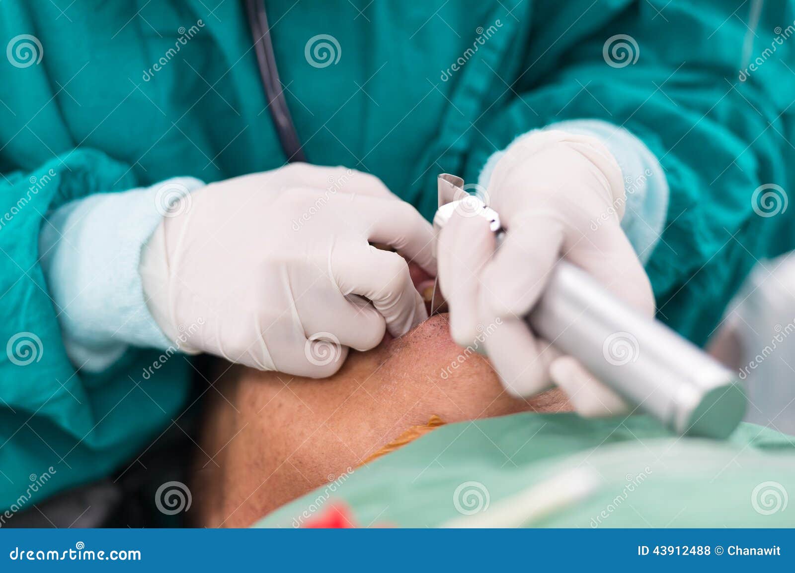 apply laryngoscope blade for insert endotracheal tube