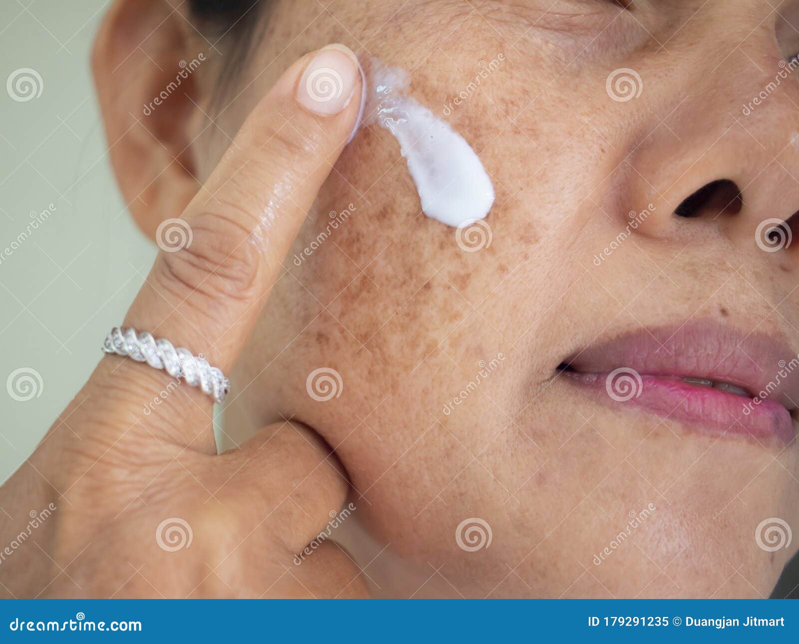 applying cream treatment skin