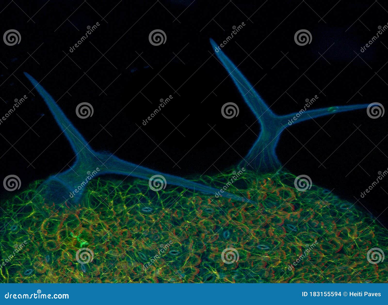 arabidopsis leaf hairs: trichomes