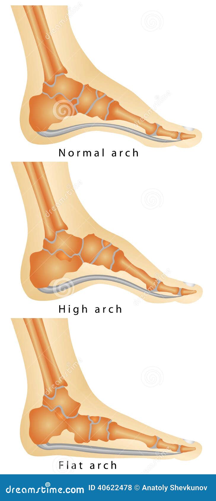 Arch of Foot stock vector. Illustration of condition - 40622478