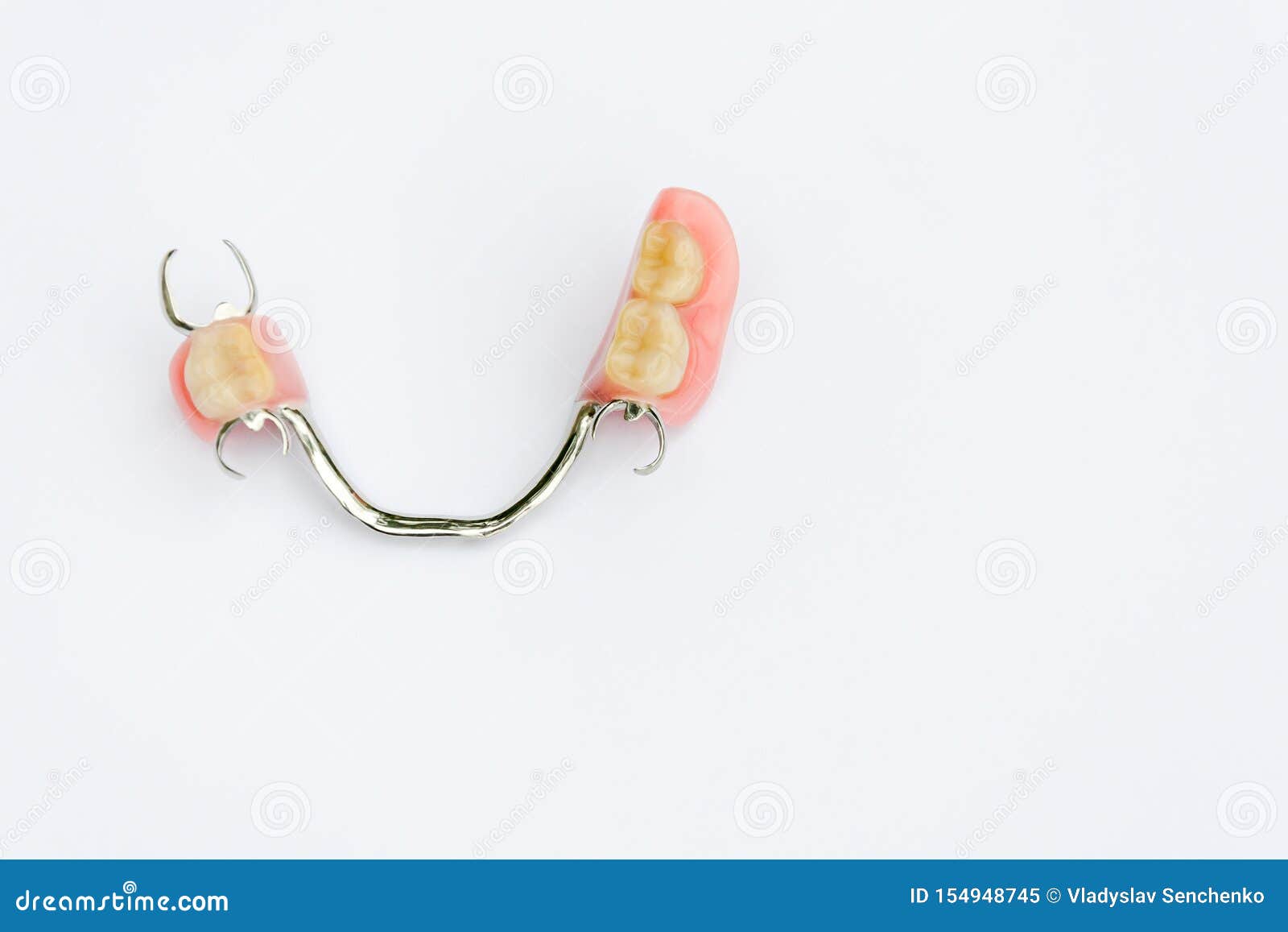 arch prosthesis on the lower jaw without crowns