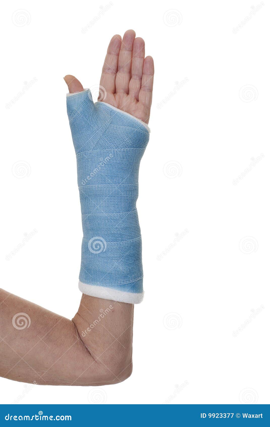 Arm in blue cast stock image. Image of left, background - 9923377