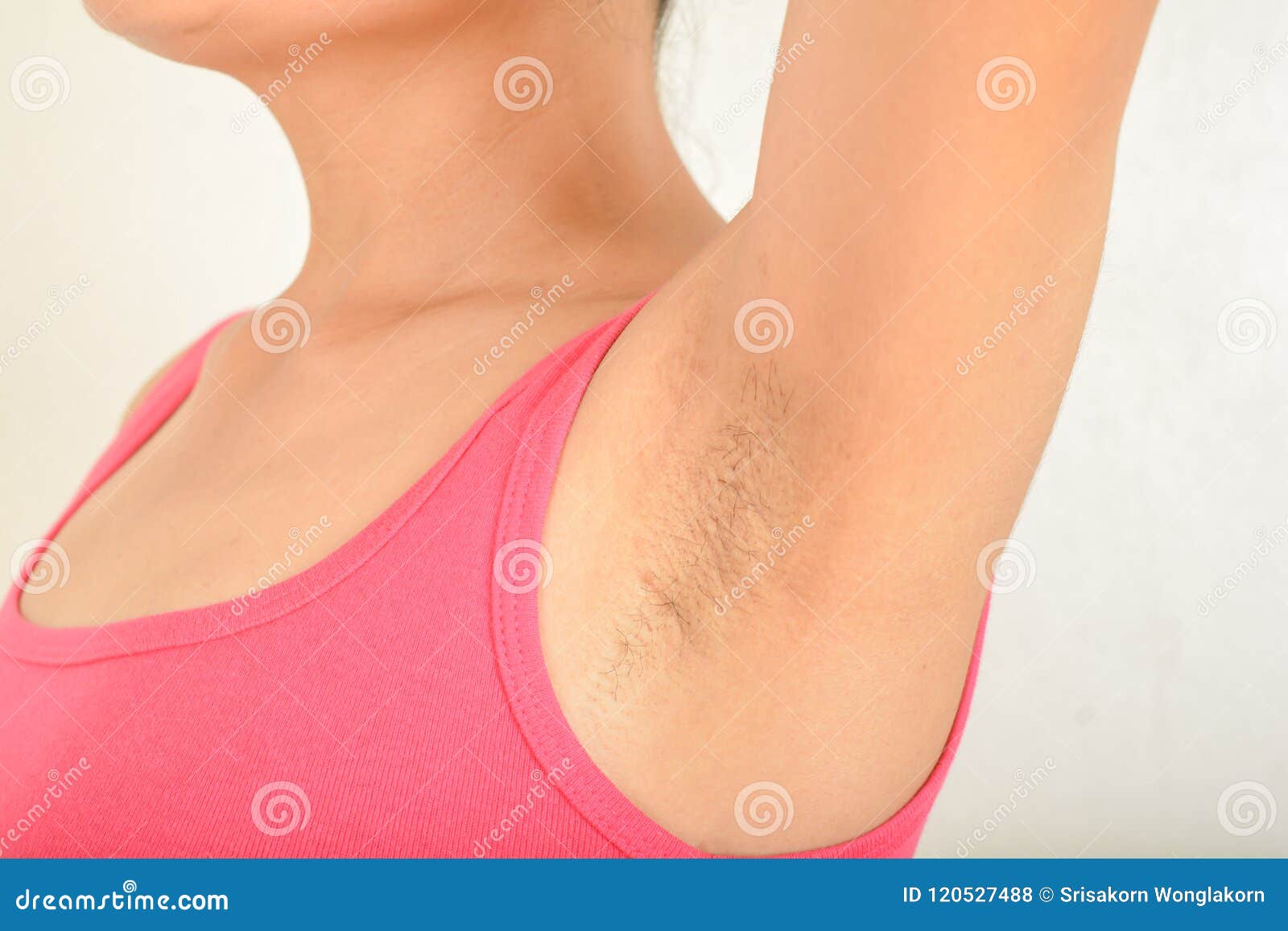hairy armpits and black spots