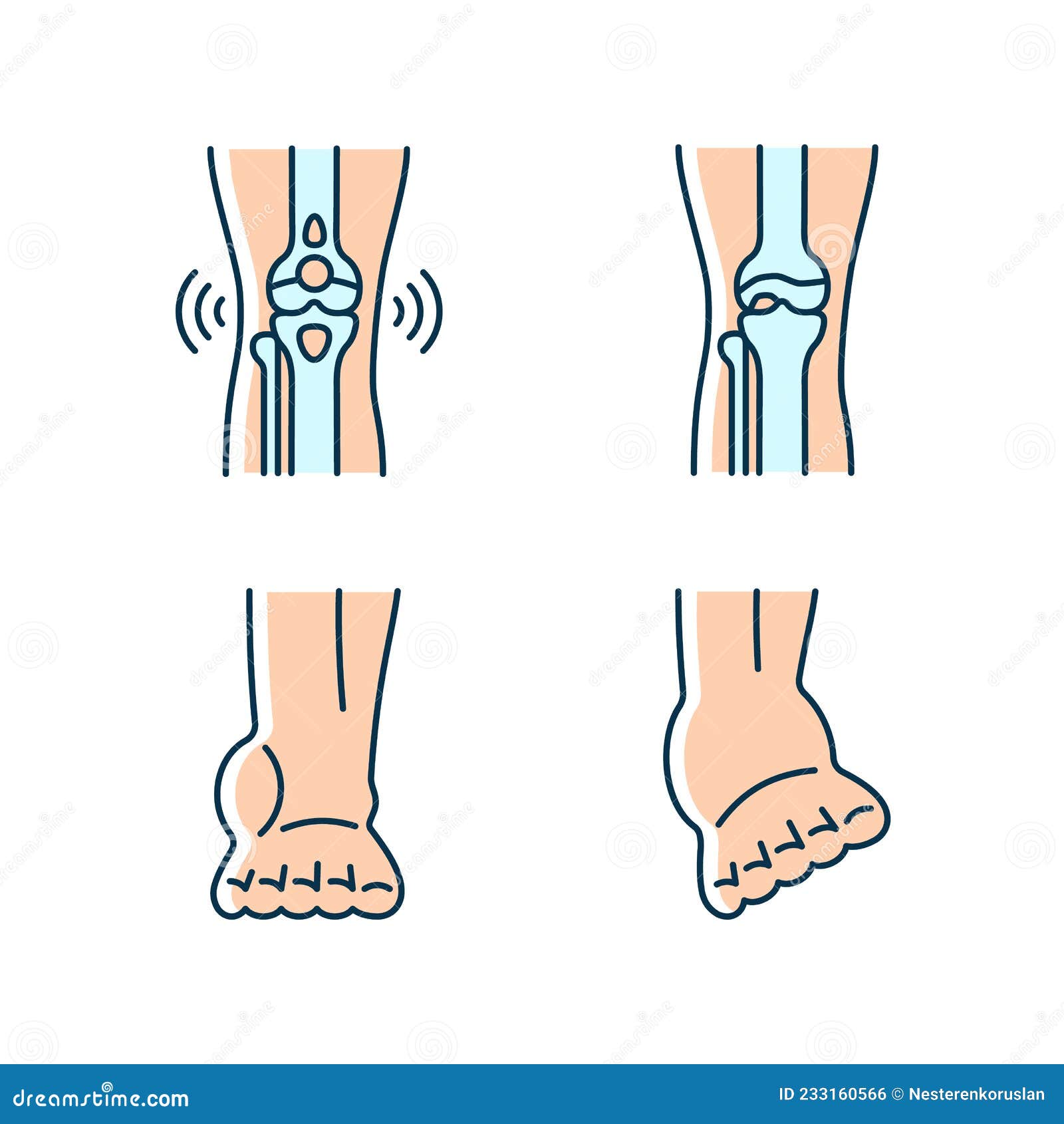 Sprained Ankle Injury Cartoon Vector 283859655