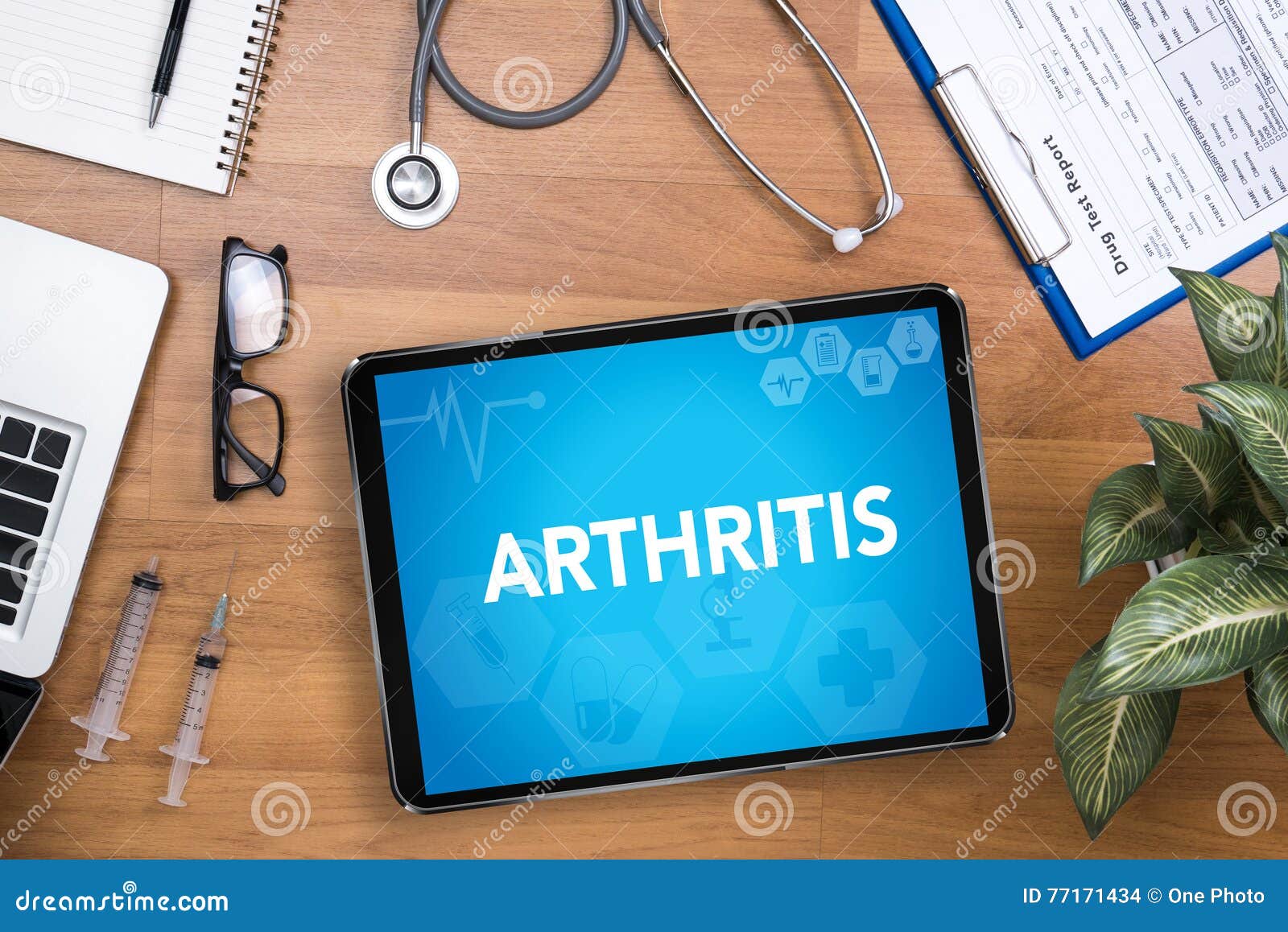 arthritis