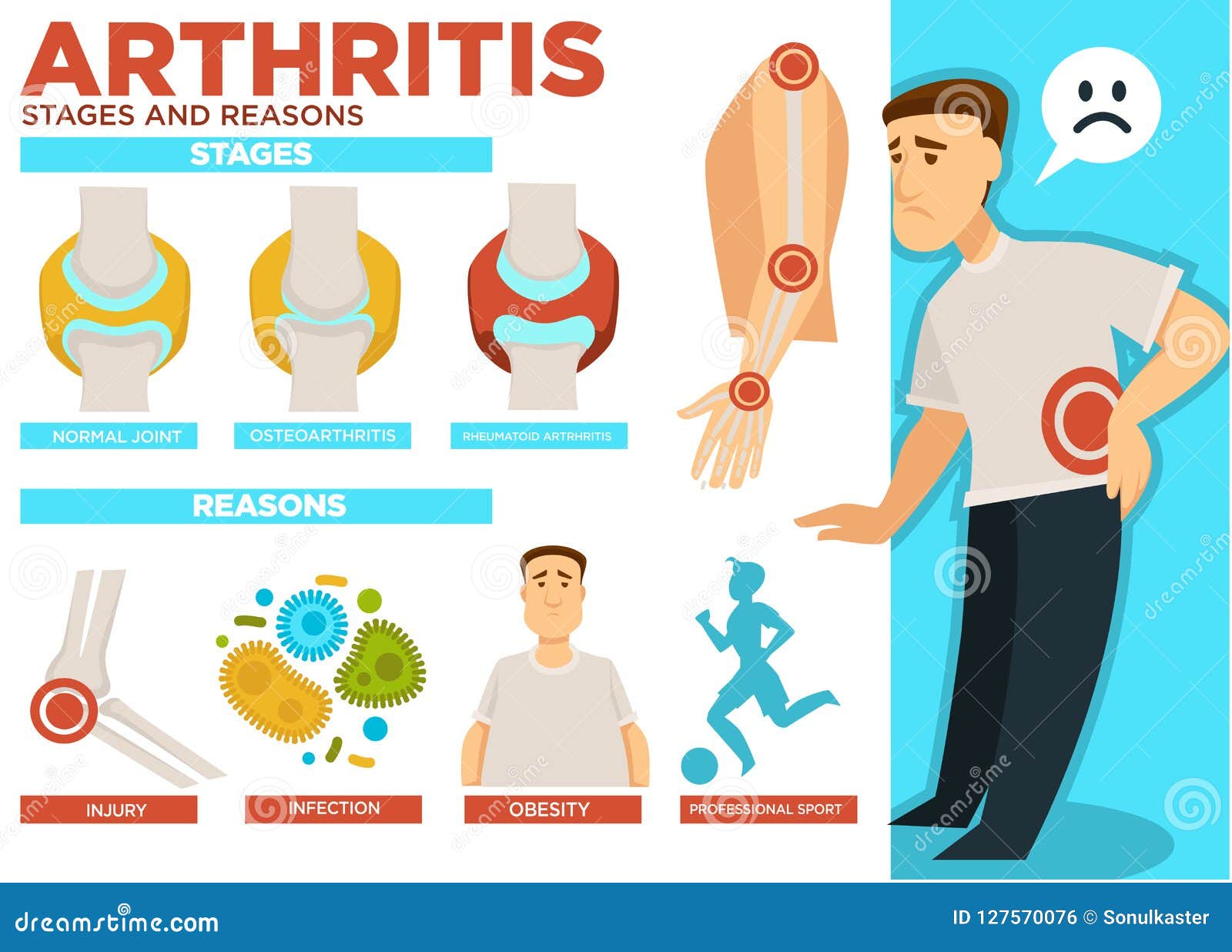 rheumatoid arthritis stages of disease)