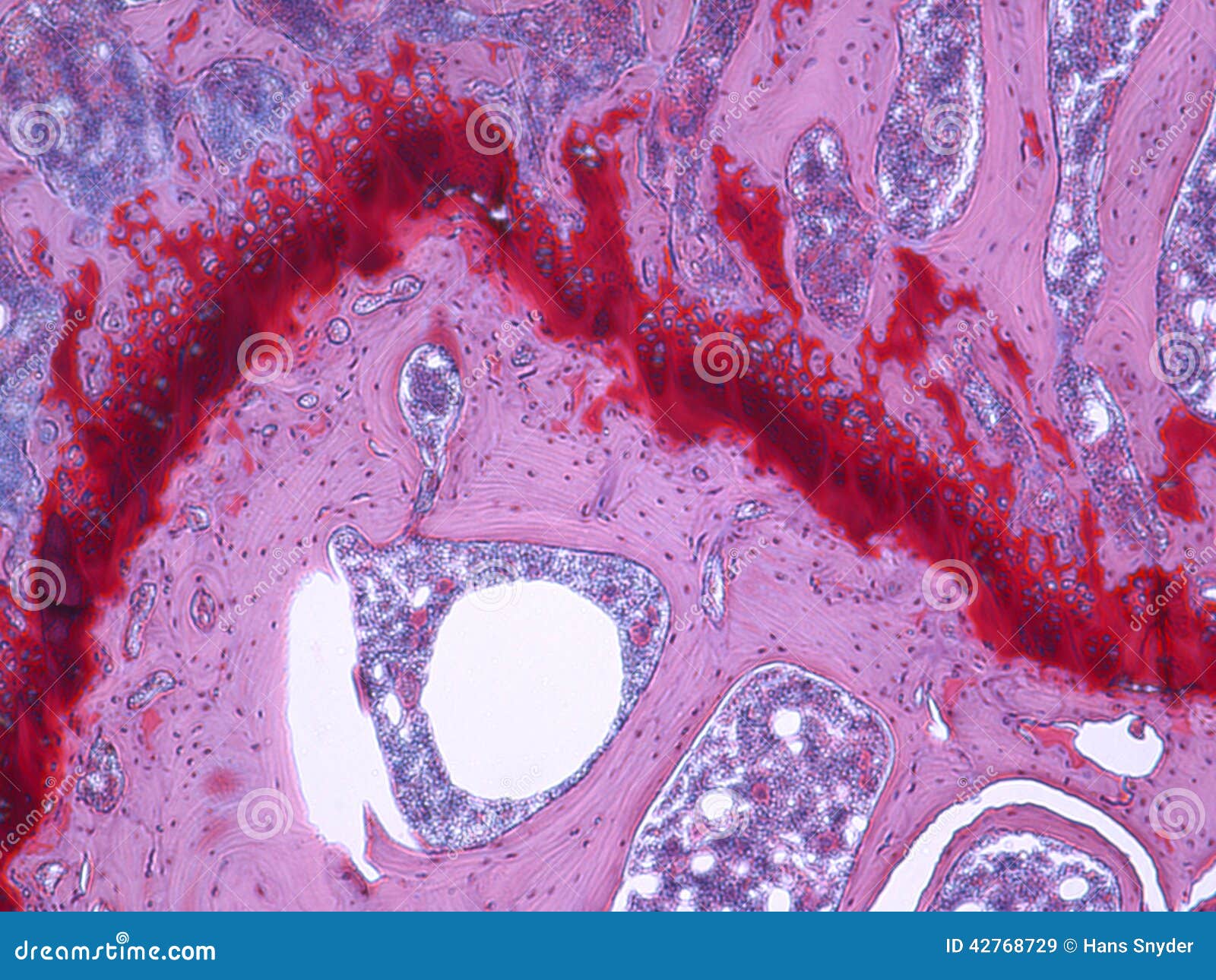 What Is Articular Cartilage