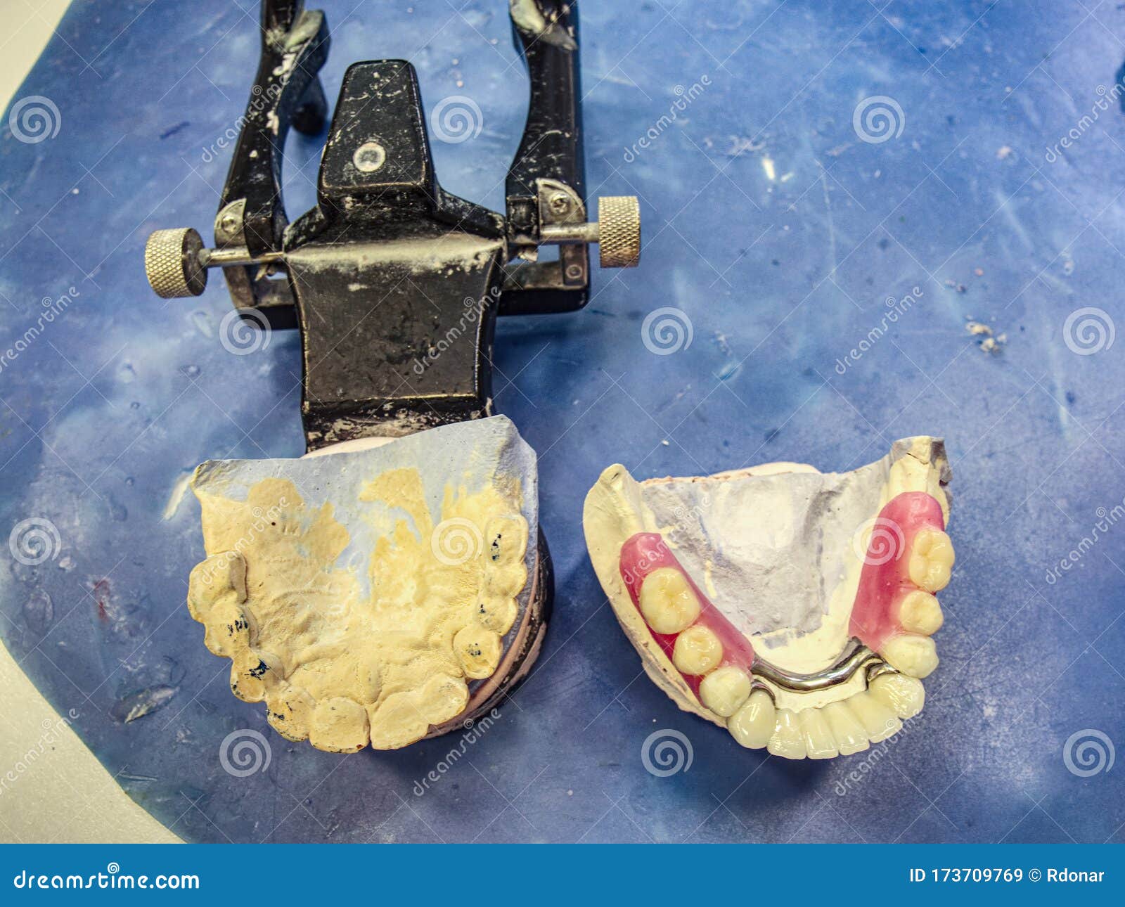 Articulator in Dental Lab with Artificial Denture Stock Image Image