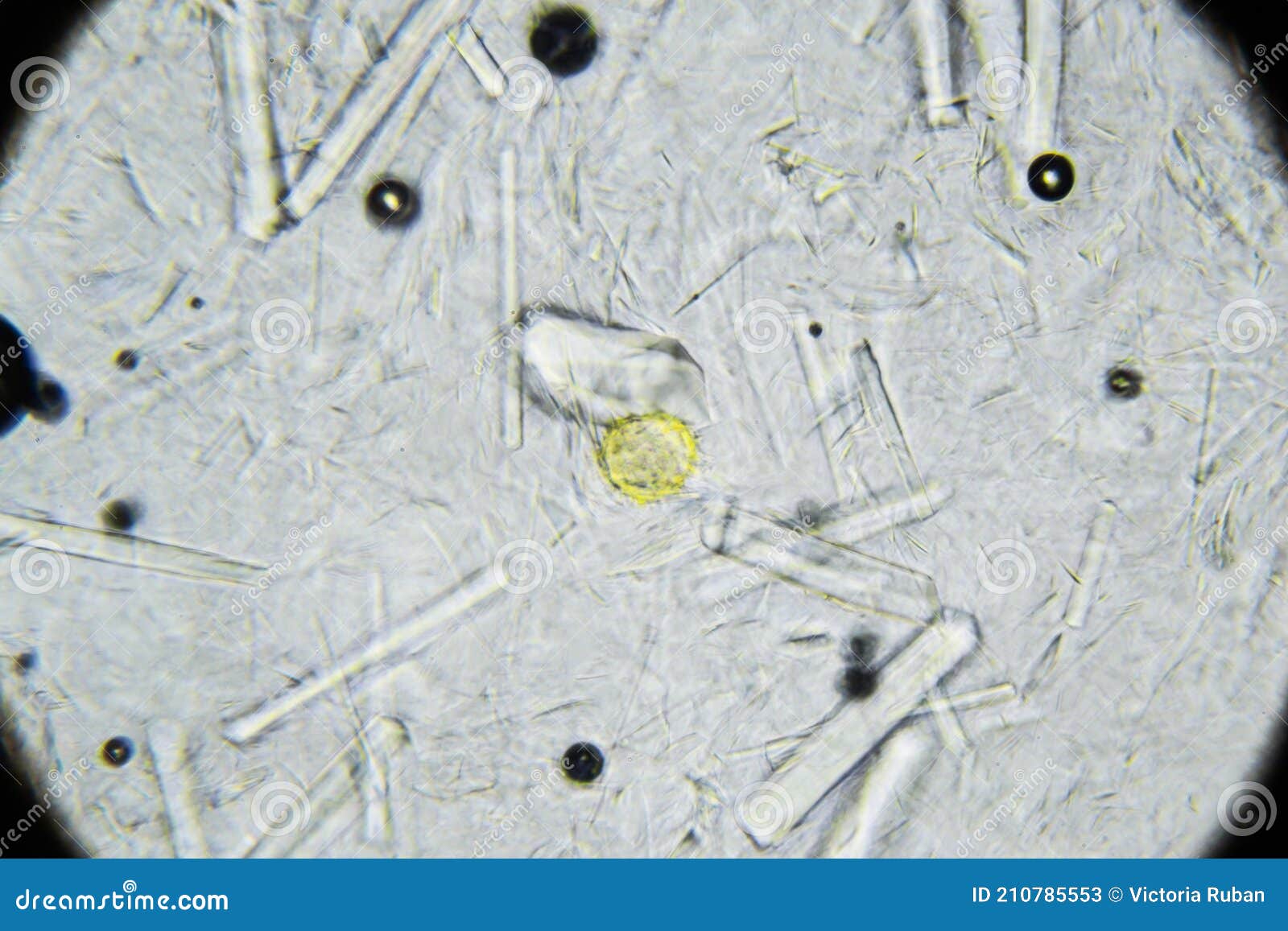 Counsel Charles Keasing Frail Sugar Crystals Under Microscope Stock Photos - Free & Royalty-Free Stock Photos from Dreamstime Counsel Charles Keasing Frail Sugar Crystals Under Microscope Stock Photos - Free & Royalty-Free Stock Photos from Dreamstime