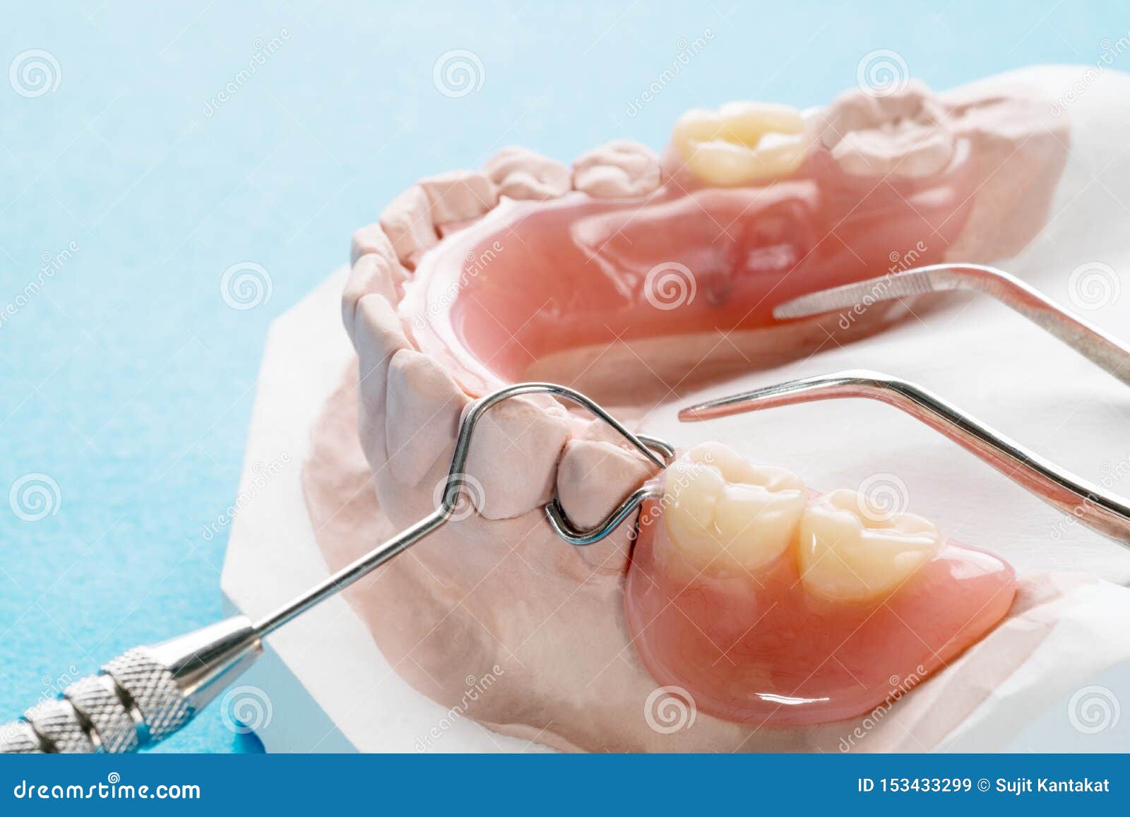 Artificial Removable Partial Denture. Stock Image Image of plastic